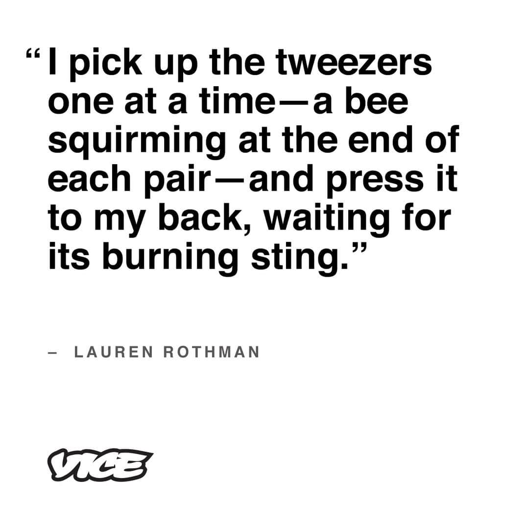 VICEさんのインスタグラム写真 - (VICEInstagram)「While bee venom therapy (BVT) is an ancient treatment, the identification of its effectiveness in treating Lyme disease was discovered by accident eight years ago. 🐝 🤒 Read more about BVT—why people may willingly sting themselves with bees multiple times a week—at the link in bio, via @tonic.」4月28日 8時01分 - vice