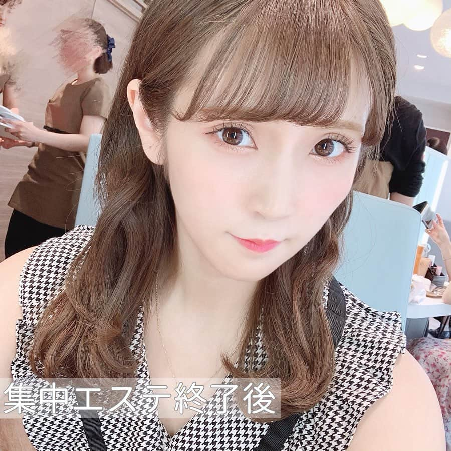 五十嵐茉優さんのインスタグラム写真 - (五十嵐茉優Instagram)「ㅤ ナリス ビューティーサロン池袋店で 小鼻集中エステを体験してきたよ🧖🏻‍♀️💗 ㅤ 鼻がコンプレックスだからノーズシャドーとか 濃くいれがちなので結構鼻の毛穴とか 気になっててすごく楽しみにしてたの💭 ㅤ ナリスの拭き取り化粧水で綺麗に鼻を拭き取って 古い角質を取り除いてから色々してもらって 最後には1万円以上もするパックをぬってもらったの！ 毛穴が綺麗になって鼻まわりの肌色がいつもと違う🥺✨ 肌に詰まってた汚れが綺麗になった！ 動画で伝わりきってない感満載だけど 本当に感動しちゃった（ ; ; ）！！ ㅤ 私が体験させてもらったのと同じ小鼻集中エステは 6月いっぱいまで1,000円でできちゃうみたい👌🏻 とってもお手頃な値段で施術してもらえるのも 魅力的だし30分でメイク直しまで終わるから ぱっと思い立ったときに行きやすいよね🌱💭 本当に満足な仕上がりになるから是非行ってみてね🐇💗 ㅤ #ナリスエステ #ナリス化粧品 #ナリスビューティサロン #ナリス #池袋 #池袋エステ #小鼻エステ #時短エステ #時短 #肌ケア #スキンケア #美肌ケア #美活 #自分磨き #ray公認インフルエンサー」5月24日 21時00分 - mau08us