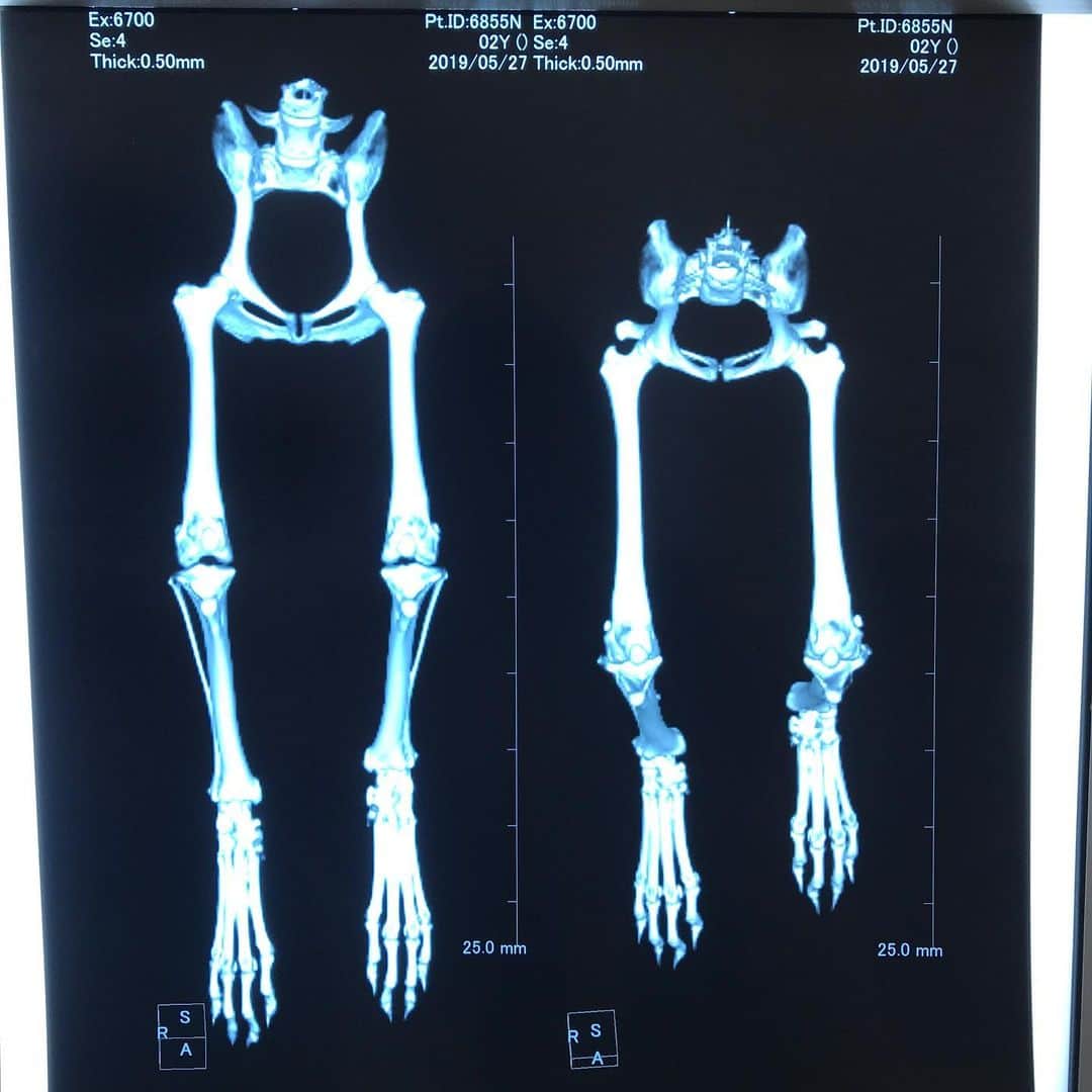 豆柴にこちゃんさんのインスタグラム写真 - (豆柴にこちゃんInstagram)「🐶🏥 ※MRIとCT写真あり。 苦手な人はスライドしないでね . #にこの右足闘病記 . 検査から無事帰還しました✨ . 今回の検査はこれから パテラ手術するにあたり、 . ●脊椎障害の有無 ●大腿骨、脛骨の変形の有無 . を調べるためにMRIとCTをとりました。 ※検査代11万😱 . これらがパテラに起因してたりすると 手術法も変わるらしく。 . 結果、にこは異常なしでした❣️ なので一般的なパテラの手術でよいそうです。 . ただ、腰の可動領域が広いようで 今は異常ないけど追々腰回りの病気になる 可能性があるらしい💦 ヘルニアとか、尿疾患とか。 予防のしようがなく、 太らないように気をつけてくださいとのこと。 . そして、 入院は6/11、手術が6/12で入院期間は約２週間、 手術は左右同時にやるそうです。 ※手術入院費60ー70万😱 にこは体小さいから安い方みたい . 残念ながらにこの誕生日6/23は 病院で一人で過ごすことに😭苦笑 . まあ仕方ないね！ . にこの手術内容は以下2点です。 ●滑車溝再建 →膝の溝を深くする . ●脛骨粗面転移術 →位置が高すぎる膝のお皿の位置を下げる . あと、前回私の認識が間違ってたのですが 右足の痛みは靭帯の部分断裂ではなく、 膝の前十字靭帯の変性、というものでした。 . パテラで骨の噛み合わせが悪いせいで、 前十字靭帯が変な収縮を繰り返し、 切れてはいないけどゆるんで腫れて痛いみたいな。 . これは治らないみたいです💦 なので切れてしまう可能性もあるけど、 パテラの手術すれば変な収縮はしにくくなるので 今より悪化は防げるらしい。 . 1ー3枚目は麻酔から覚めたにこ。 目の下クマができてゲッソリしてる😮 と思ったら、目が乾かないような液を 目に入れてたらしくそれが付着してるとのことでした😆 . ひとまず、よくがんばりました❣️ . 長文失礼しました . #柴犬#豆柴#pecoいぬ部#犬#わんこ#犬#ここ柴部#shibainu#dog#mameshiba#pecotv#dog#いぬのきもち部#しばいぬ#しばけん#こいぬ#シバイヌ#いぬ#イヌ#赤柴#マメシバ#ペット#日本犬#子犬#puppy#doggo#pet」5月27日 16時03分 - nikochan.mame48