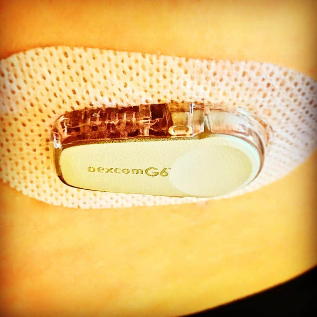 エリザベス・パーキンスさんのインスタグラム写真 - (エリザベス・パーキンスInstagram)「Just started on the DexcomG6 CGM to continuously monitor my glucose levels. Data goes straight into my IPhone through a transmitter so I receive real-time readings and trends. A-mazing. The future is already brighter. ✌️♥️ @dexcom #dexcomg6 #type1 #LADA #autoimmunedisease」5月5日 3時59分 - elizabethperkins