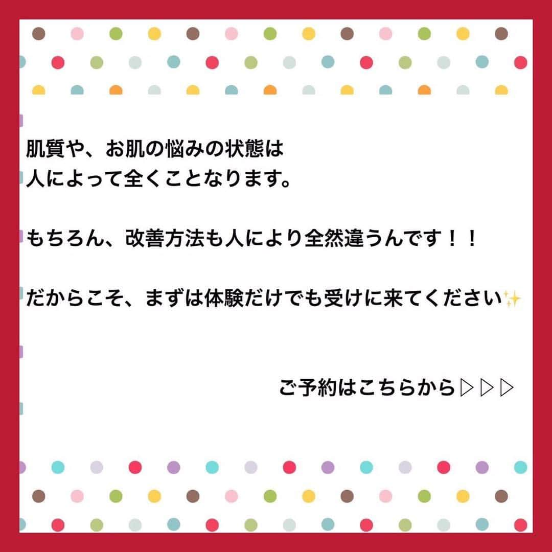 肌質改善専門サロン~Accueil~さんのインスタグラム写真 - (肌質改善専門サロン~Accueil~Instagram)「💙💚❤️5/5空きあり💛💜❤ * * 【ご予約はこちら👇🏼】 🌟🌟 @accueil_ikebukuro 🌟🌟 . ※今だけ期間限定クーポンあり . . . 肌荒れの原因は人それぞれなのにも関わらず、 周りの人と同じケアをしていませんか💦？？ * ❌お薬を塗っても飲んでも変わらない、、 ❌食事を気にしても肌が荒れる、、 ❌スキンケアを変えてもイマイチ、、 ❌何かしら常にトラブルが肌にある、、 ❌ニキビが繰り返しできる、、 * * そのお悩み解決できちゃいます😌✨ Accueilは、どのサロンに行っても良くならなかったお客さまたちや、 どの皮膚科に行っても変化がなかったお客さまたちが多く訪れてくださっています🙌💕* * * * もう悩まない！！！ 繰り返さないところまでしっかりと根本改善していきます☺️ そろそろ肌荒れから卒業しませんか？ * →→→初回体験はこちらから👉🏼 @accueil_ikebukuro * * * * Accueilでのお手当は、、 * 機械は一切使いません🙅‍♀️❌ 使うお化粧品は １００％天然の「ミネルヴァ化粧品」🌲🍃 ニキビの炎症がある方・アトピーの方でも 安心して受けていただける事ができる お肌にとても優しいエステです♡♡ * * お肌のお悩みなら、何でもお任せください😊💕 * * ■「インスタ見ました！」 で、 初回体験￥26,000 →→✨￥５，９８０✨ * * * --------当サロンのご予約方法≫--------- *  1️⃣当サロンのインスタTopのURL ⭐『Hotpepper Beauty』の 「instagram限定クーポン」にてご予約可能♡♡ * * 2️⃣インスタのDMからご予約 （下記項目を記載の上、お問い合わせください♪） * 🔶お名前（フルネーム） * 🔶お電話番号 * 🔶希望日時（第１～第３希望） * 🔶ご希望のメニュー * * 3️⃣お電話でのご予約✨ 　03-6912-5705にお願いします♡ ----------------------------------------- * * @accueil_ikebukuro ✨ #ニキビ #ニキビ跡 #毛穴 #乾燥肌 #ニキビ跡ケア #肌荒れ #ニキビ跡改善 #ニキビ肌改善 #ニキビ治療 #保湿 #毛穴の黒ずみ #毛穴の開き #スキンケア #毛穴吸引 #アトピー女子 #ニキビ皮膚科  #美肌ケア  #ニキビ専門 #肌質改善 #背中ニキビ #アトピー肌 #乾燥 #ニキビケア #毛穴ケア #アトピー治療 #肌悩み #スキンケア難民 #肌トラブル改善 #スキンケア大事 #目指せ美肌」5月5日 8時34分 - accueil_ikebukuro