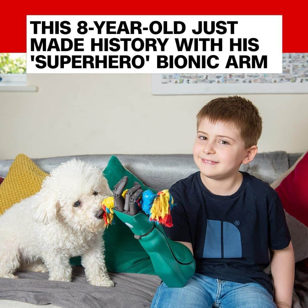 CNNさんのインスタグラム写真 - (CNNInstagram)「An 8-year-old British boy who was born without a right hand made history as the youngest and smallest person to be fitted with an advanced multi-grip bionic arm, according to manufacturer Open Bionics. The “Hero Arm,” which translates electrical signals into a series of grips and movements, will help Freddie Payne pick up delicate objects, grip playground equipment and high-five his friends. Freddie’s mom said he was “beside himself with excitement” over the new arm and “couldn’t wait to move his fingers.” (📸: SWNS.com/SWNS-Cambridge)」5月5日 16時00分 - cnn