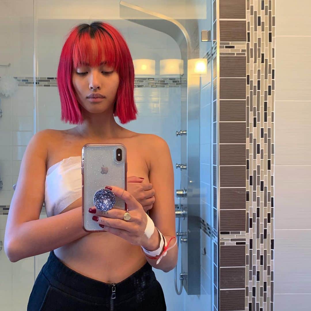 エマリン・エストラーダのインスタグラム：「If you know me well, you know that I like to keep certain parts of my personal life private. But recently, I realized that my story is important to share with you and I hope can encourage you to check yourselves and get regular preventative health screenings.  I never thought that at 26 years old, I would have to worry about the possibility of having breast cancer. Although I’ve been aware for a few years now that I am positive for the BRCA1 genetic mutation, it never crossed my mind that I should be getting routine checkups and MRI’s. I definitely didn’t worry about it because for me, I never manifested/believed that I would ever get breast cancer.. unfortunately that’s not enough. I found out I have a fibroadenoma, a benign tumor that is very common for women my age. Luckily for me, I had the tumor removed today. For other women like my mother, my aunt, my cousin and my grandmother who all suffered from breast cancer, were not as lucky to detect it early enough. Early detection is absolutely key to successful treatment and survival. But annyyyway it’s not that serious, I just wanna be real with you guys and to all my friends who think I’ve been MIA for no reason lol. HEALTH IS WEALTH, don’t worry, she’s almost back to 💯💯💯」