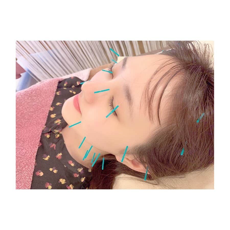 のインスタグラム：「⠀ 中学の友達が、久留米でサロンしていることを知り、行ってきました♥️ 美容針とボディーケアやってもらったけど、めちゃくちゃ気持ちよかったし、スッキリした🥺 ⠀ 会うのが久しぶりだったから 針してもらってる間 喋りすぎて怒られた（笑）（笑） ⠀ 駅から近いし 女の子だけじゃなく、男の方も出来るみたいなので、興味がある方は是非♥️🥰 タグ付けしてます🌼 ⠀ オーナーさん、またよろしくお願いします☺️笑 #美容針 #ボディーケア #久留米」