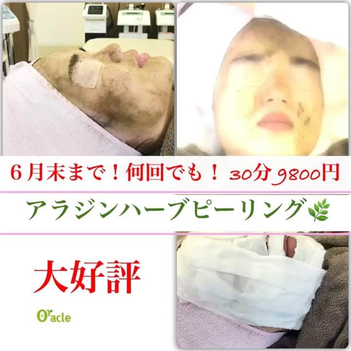 オラクル美容皮膚科東京新宿院のインスタグラム
