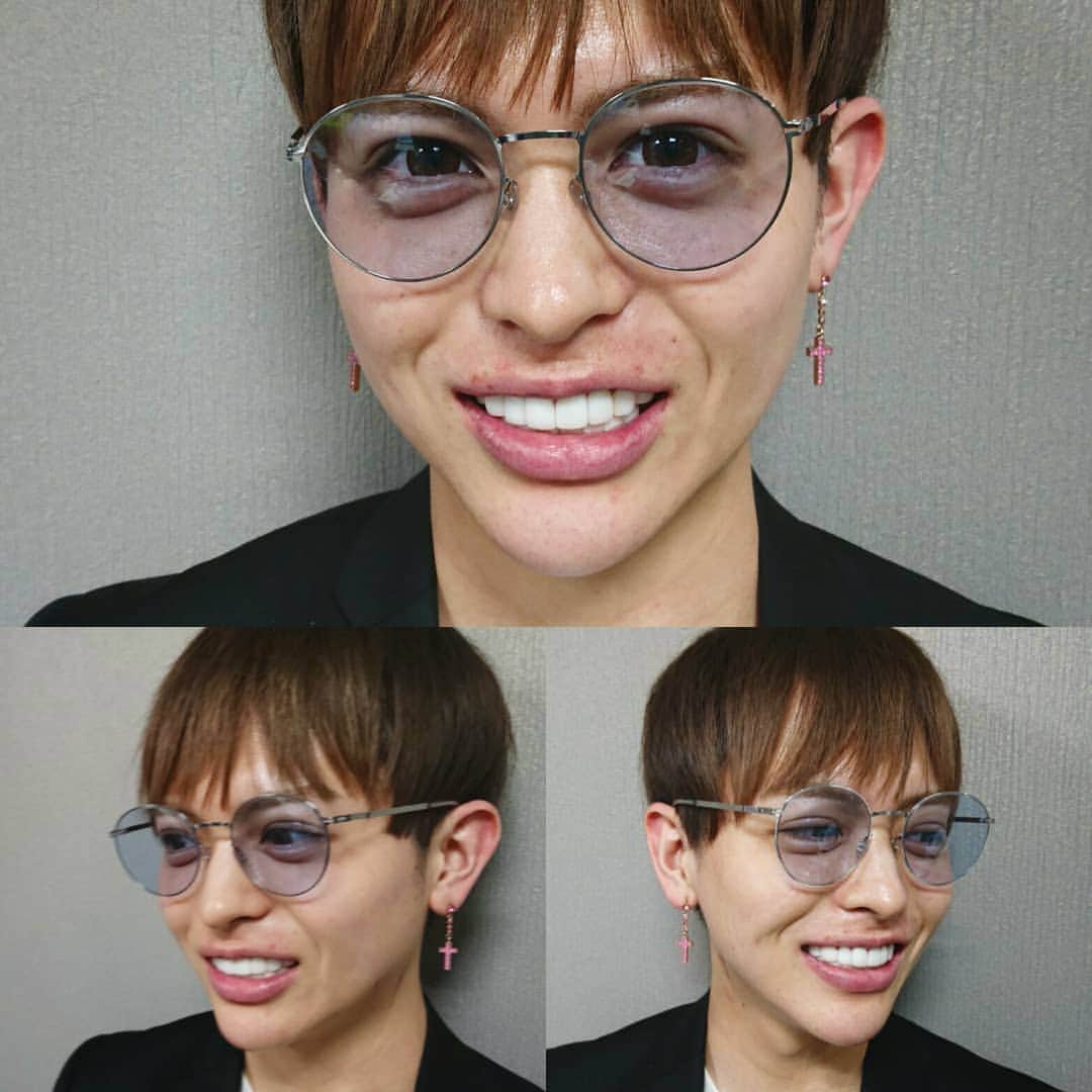 のインスタグラム：「スーパーベニアというアート作品❗ @superdentist5  美しい歯と歯並びが 美しい顔をつくるんです❗  どんなに顔を綺麗に変えても 歯が綺麗にならなければ 絶対に綺麗な顔にはならないんです❗  美しい顔になりたければ まず最初に歯を綺麗に直しなさい 他のパーツは直す必要がないかもですよ❗  歌舞伎町 KG RICH 黒崎颯士くん  #歌舞伎町#ホスト#ホストクラブ #rich #クラブ#ラウンジ#キャバ嬢 #六本木 #銀座#赤坂#恵比寿#西麻布#北新地#関内 #すすきの#中洲#国分町#錦#栄#祇園#ヨガ #ミナミ#ホステス#美容整形#審美歯科#ネイル #ジルコニア#セラミック#エステ#美容皮膚科」