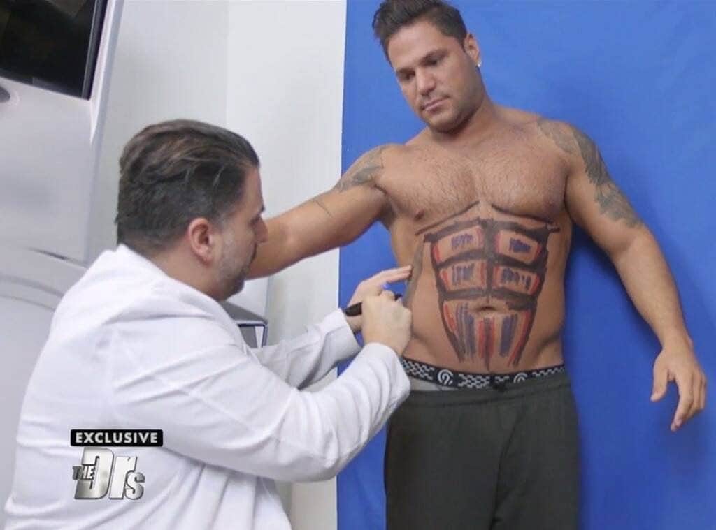 E! Onlineさんのインスタグラム写真 - (E! OnlineInstagram)「Gym. Tan. Liposuction? #JerseyShore's Ronnie Ortiz-Magro went under the knife to get a six-pack. 🗣️ His abs are here! at the link in our bio. (📷: The Doctors)」5月17日 5時29分 - enews