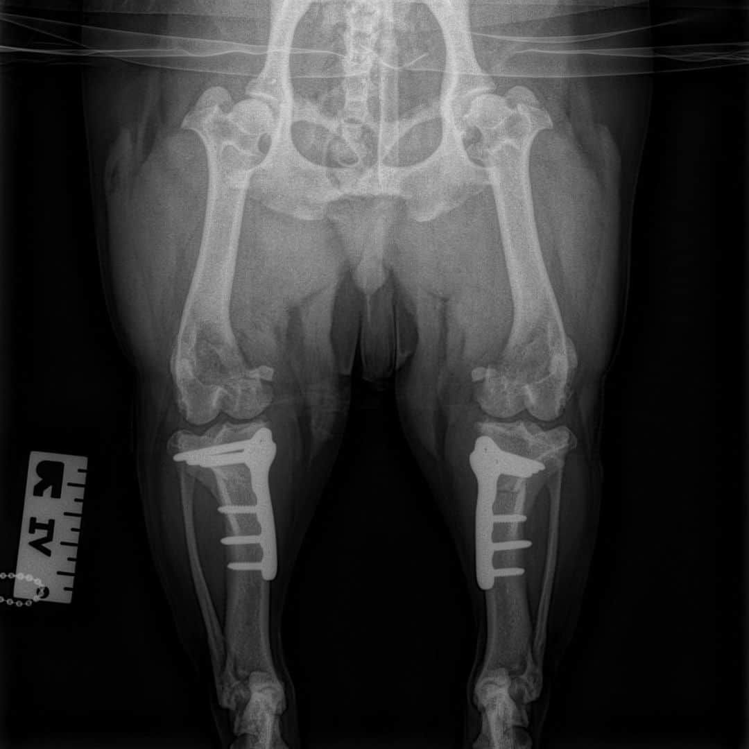 Winston the White Corgiさんのインスタグラム写真 - (Winston the White CorgiInstagram)「The symmetry! This x-ray marks 9 weeks since the right leg TPLO (your left) and 4 weeks since the left (your right). Happy to report the right leg is completely healed, and the left is tracking well and getting stronger! I gotta stay diligent with rehab, anti-inflammatory meds, omega-3s, and daily exercises. Thank you all - couldn’t do this without you! #winstonsroadtofetch」5月23日 9時41分 - winstonthewhitecorgi