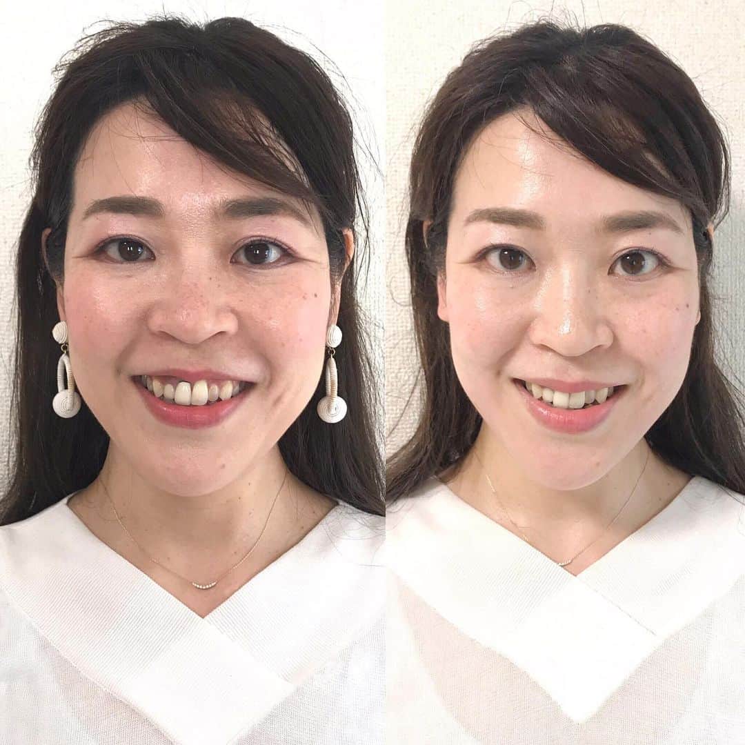間々田佳子のインスタグラム：「プライベートレッスン50分の変化  目の開き方 口元の上げ方をトレーニング  顔の動きのクセをとり 新しい動きを覚えさせる  #間々田佳子 #表情筋研究家 #フェイシャルクリエイター #顔ヨガ #顔ヨガで小顔に #整形無料 #整形自力で #むくみたれ顔解消術 #顔ヨガサロン #顔ヨガ築地」