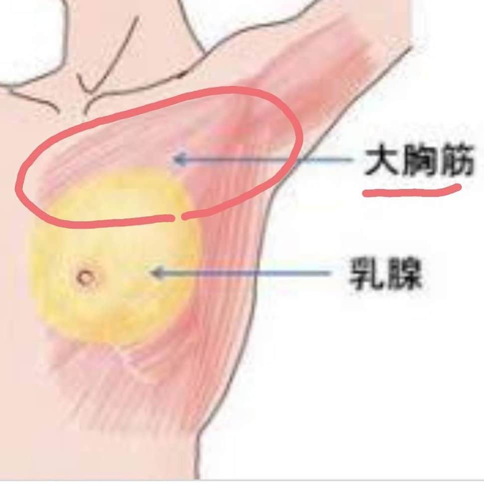 鳳山えりさんのインスタグラム写真 - (鳳山えりInstagram)「@amelie_beaute_salon . アメリーボーテ恵比寿  今日はバストの土台のお話です。  バストは主に　乳腺組織　と　脂肪組織　とでできていますが 実はこれらを支えているのが本日の主役　大胸筋　と呼ばれる土台です。  お胸と鎖骨の間くらいにある筋肉ですね。  この大胸筋、首や肩との筋肉とも繋がっています。 その為この大胸筋が固くなると、凝り　や　冷え　を増長させてしまうんです。  それだけでなく 胸が育つのに必要な土台である大胸筋が収縮され、乳腺活性化に必要な栄養や酸素をせき止めてしまい、胸が育とうにも育てない状況にッッ！  一生懸命食事やサロンに通っているのに、栄養やホルモンが隅々まで届いていないのでは育乳には難しい状態です。  この大胸筋、姿勢にとても影響をされます。 　猫背　や　巻き肩　の方はこの影響を受けやすいんです。  じゃあ大胸筋鍛えればバストアップできるの？　と思いません？  答えは　NOです。  なぜかと言うと、お胸は乳腺組織と脂肪で出来ています。 その下に土台となる筋肉があるため、その筋肉を鍛えすぎてしまうとお胸の脂肪を燃やして筋肉に変えていってしまうためです。  大切なのは　姿勢を改善しながら大胸筋を緩め、沢山の栄養やホルモンを行き届かせること。  近年携帯、パソコン等の普及により前屈みの方が増えてきております。 少しの意識とセルフケアでも変われます！ 時間のないときは入浴中にするのがおすすめです。 ボディソープでマッサージすれば洗いとマッサージが一度にでき、更にしっかりと入浴してからすれば温効果もあり血行もアップ！ 一石二鳥……いえ、三鳥ですね！(*ゝω･*) 自分で育てる育乳のお手伝いさせてください☆  お問い合わせの多いこちら💁‍♀️ 🌟新スタッフ近藤限定★痛くないオールハンドバストアップ90分¥10800 💝近藤限定メニュー空き状況💝 21日(金)14:00 26日(水)11:00〜14:00 27日(木)11:00〜12:00 28日(金)11:00 . ♥️他メニュー空き状況❤️ 6/19(水)10:00〜12:00、15:30〜20:00 6/20(木)12:30 6/21(金)10:00〜17:00 6/22(土)19:30、20:00 6/23(日)10:00、18:30〜20:00 🌟新規の方オススメメニュー🌟 💜ラジオ波&育乳マッサージ60分18900円 ❤️ラジオ波&育乳マッサージ60分✖︎3回 口コミモニター¥38800 🌟痩身 くびれor美脚or二の腕90分¥12800 🌼オプション→エンビロンビタミン導入6800円 . 💝新規、再来様も可能な期間限定メニュー💝 . 再来の方も都度払い、コース、お客様それぞれ通いやすい方法で通って頂けます😉 . カード払いも、もちろん大丈夫です⭐️⭐️⭐️ . お問い合わせ、ご予約は #LINE@から LINEからID検索で（@akg5081i） 必ず@マークを入れて検索してください！ もしくはこのままDMでも(^^) . お電話予約は 080-3585-0512まで！ #バストアップ #バストアップ効果 #バストアップマッサージ #育乳 #育乳ブラ #育乳マッサージ #豊胸 #ヒアルロン酸豊胸 #アクアフィリング豊胸 #産後ケア #桶谷式母乳マッサージ #桶谷式 #断乳後 #ペチャパイ #貧乳  #育乳サロン #ブライダルエステ #アメリーボーテ#エステ#フェイシャル #ブライダルエステ#産後エステ#バージスライン #美魔女 #美容おたく #エンビロン #ダーマロジカ#バストケア #ハンサムバスト」6月18日 22時01分 - eri_toriyama