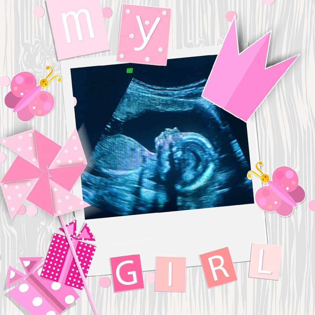 メーガン・デュアメルさんのインスタグラム写真 - (メーガン・デュアメルInstagram)「Found out today that the little person growing inside of me is going to be a mini me!! 🤰  #babygirl #genderreveal #pregnancyweek19 #itsagirl」6月19日 8時50分 - meaganduhamel