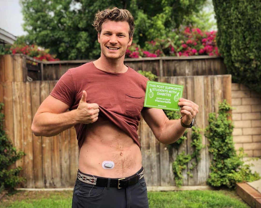 デレック・テラーさんのインスタグラム写真 - (デレック・テラーInstagram)「Tomorrow is #NationalSelfieDay and I’m teaming up with my fellow Dexcom Warriors to raise awareness for continuous glucose monitoring, and raise money for students with diabetes!  Join in tomorrow by posting a photo showing off your #CGM sensor. Use #SensorSelfie and tag @Dexcom. For every post, Dexcom will donate $1 to @collegediabetes and students with #T1D! #WarriorUp #sponsored #selfie」6月21日 7時05分 - derektheler