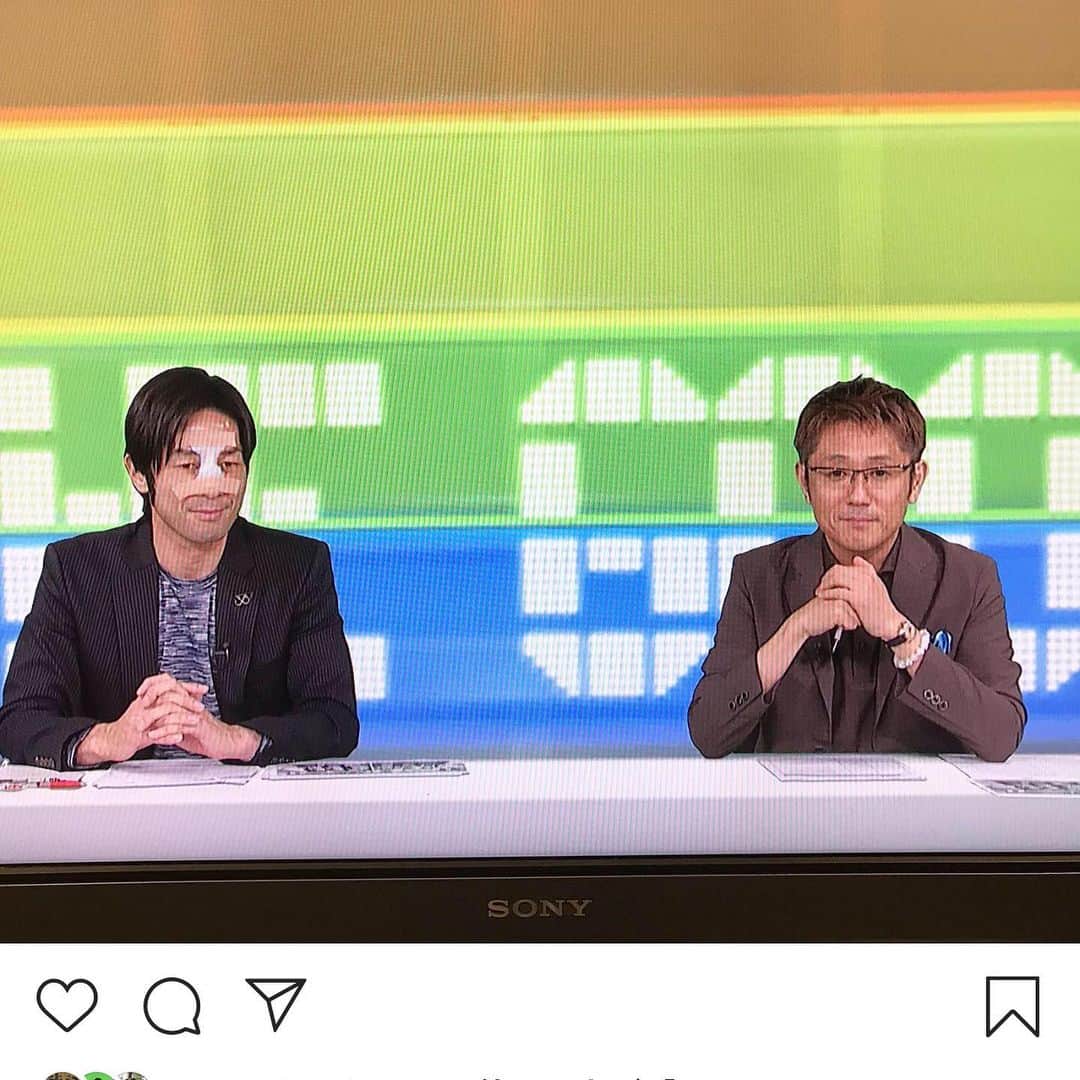 柴村直弥のインスタグラム：「#鼻骨骨折 #複雑骨折 #経過 #順調  #foot!で振り返り #jsports」