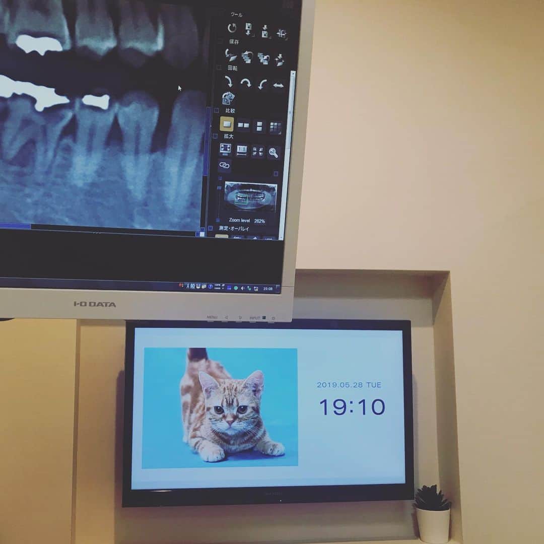 石川龍のインスタグラム：「今日も今日とて歯の治療。奥歯一本のために今日で3回目の通院。まだ終わらず、、。もっと早く病院行くんだったなぁ。 そしてこの病院、なぜか目の前のモニターにいつもこの挑戦的な目つきの猫が映しだされています。どうしてこの画像なんだ、、。もっとほんわかした画像でリラックスさせてくれても良いではないか、かわいいけど。」