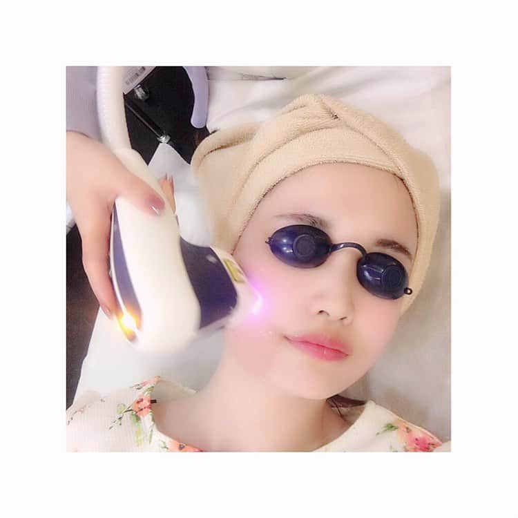 浅井麻里さんのインスタグラム写真 - (浅井麻里Instagram)「✨✨﻿ ﻿ この前お仕事の合間に、﻿ 青山セレスクリニック @aoyama.celesclinic へ🎵﻿ 即効性がある！っていう﻿ メディオスターリフトを受けてきました❤️﻿ ﻿ 医療レーザーで顔を照射するだけで、﻿ 簡単にリフトアップができるメディオスターリフト✨﻿ 顔にメスを入れるのは怖くて絶対無理！！🙅‍♀️﻿ だから、レーザー当てるだけで﻿ リフトアップできるって嬉しい💕😊﻿ (照射中の写真3枚目を見てね！﻿ ゴーグル付けてる顔が地味に笑える…🤣笑)﻿ ﻿ 副作用やダウンタイムなくて、﻿ むしろ肌にいい❤️﻿ 真皮層の活性化を促して﻿ コラーゲンを増やしてくれるから﻿ 肌にハリやツヤが出るのー❤️﻿ すぐフェイスラインがシュッとなったのも﻿ びっくりしたけど、﻿ 肌モチモチ気持ちよくてそこにも感激💓☺️﻿ ﻿ ﻿ 照射時にピリッとした痛みが時々あるけど、﻿ すごく短時間だし全然耐えられるレベル！﻿ 即効性あるし短時間で終わるから、﻿ お仕事終わりとかに来る女性も多いみたい🎵﻿ ﻿ 初回お試し価格もあるから、﻿ 気になる方は試してみてねー✨🙋‍♀️﻿ ﻿ ﻿ #青山セレスクリニック#船橋中央クリニック#川口美人#美容外科#美容皮膚科#メディオスターリフト」5月28日 21時10分 - mari_asai_625