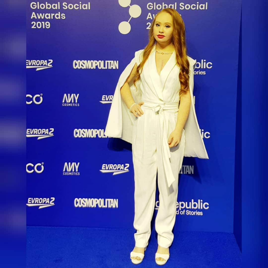 マデリン・スチュアートさんのインスタグラム写真 - (マデリン・スチュアートInstagram)「Blue carpet @socialawards  Styled @rosannestuart  Dressed @sheikeandco  Hair and Makeup @martasantorova  #thinksocial #inclusion #love #diversity #metgala」5月30日 2時42分 - madelinesmodelling_