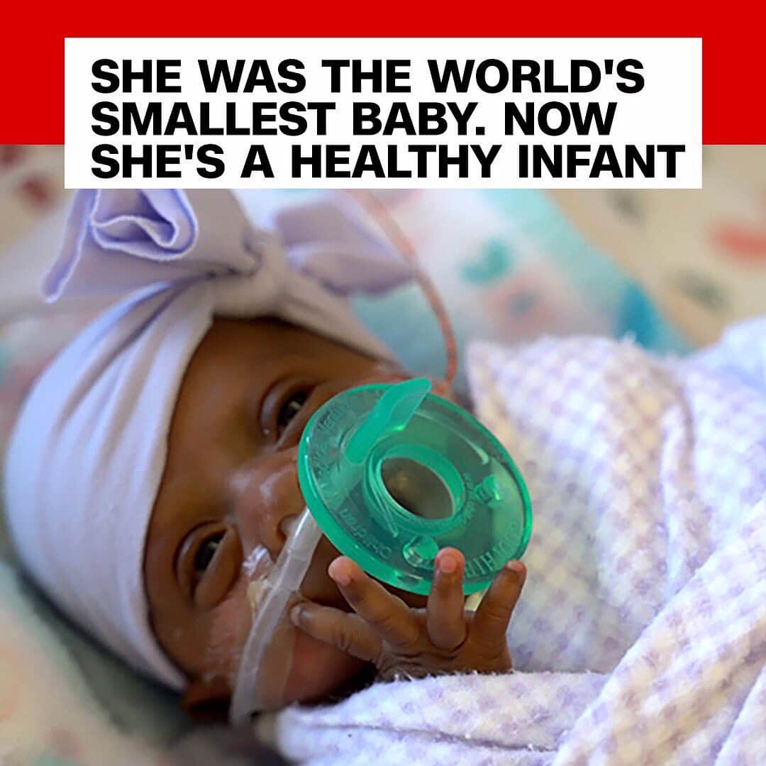 CNNさんのインスタグラム写真 - (CNNInstagram)「Baby Saybie was born prematurely in December, weighing just 8.6 ounces - about the weight of a large apple — making her the smallest surviving baby in the world, according to officials at Sharp Mary Birch Hospital. After nearly five months, she has left the hospital and weighs about 5.6 pounds. "After experiencing severe pregnancy complications, Saybie's mother gave birth via emergency cesarean section at 23 weeks, 3 days gestation in the womb," the hospital explained at a news conference. (📸: Sharp Mary Birch Hospital for Women & Newborns)」5月30日 22時49分 - cnn