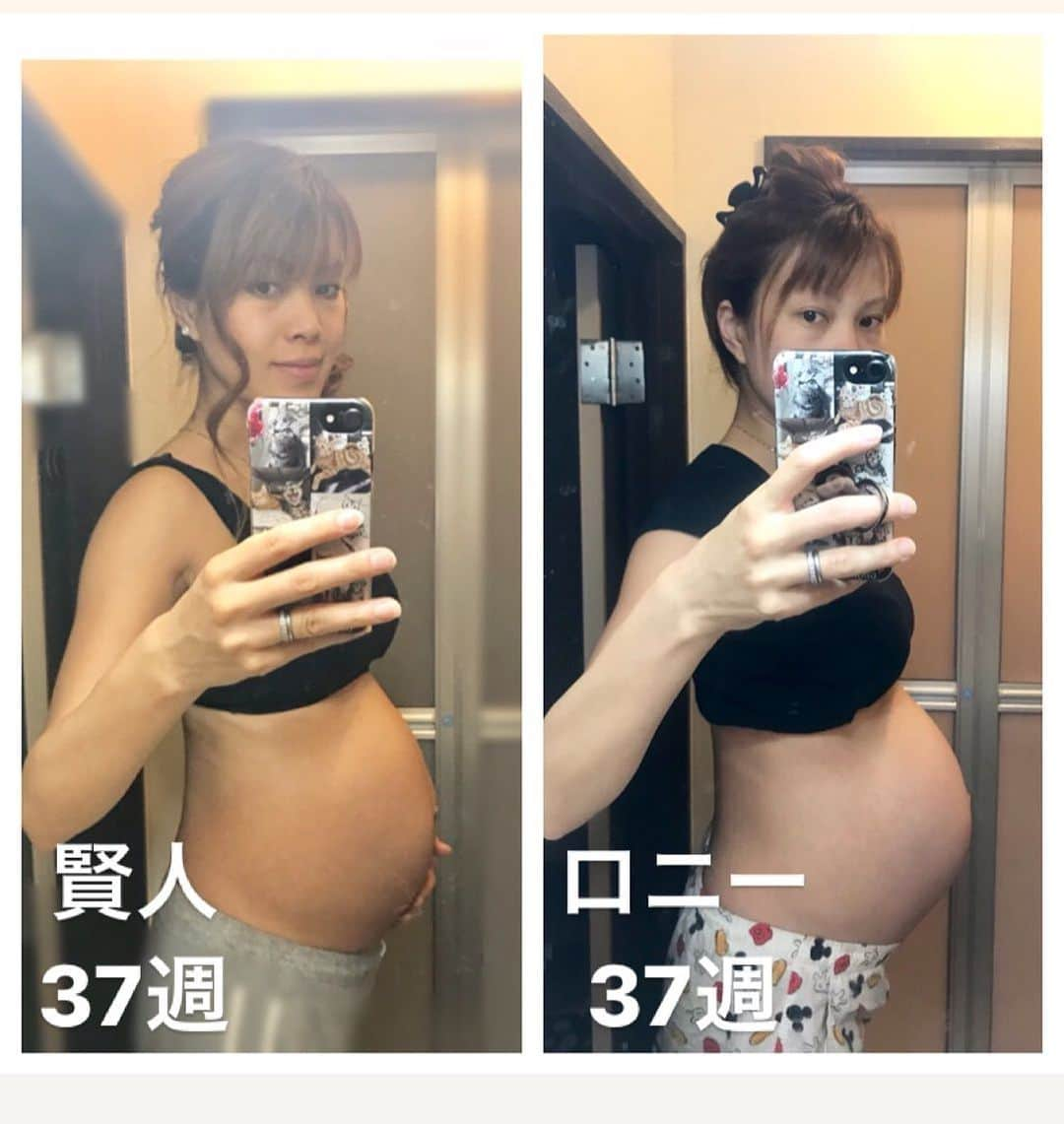 輝良まさとさんのインスタグラム写真 - (輝良まさとInstagram)「・ ついに正産期に入りましたー‼️ ここまで何事もなくお腹の中にいてくれてありがとう😊💓 ・ 先日の焼肉のジンクスは当たらずでした🤣笑 ・ 賢人の時の37週の写真と比べてみましたが、ロニーさんの方がなんだかお腹が前に突き出してる感じがします🤔 最近は良くお腹が張るし、ずっと座ってたり食後とかが特に苦しく…💦 体重もこの間までは妊娠前プラス6.5キロぐらいをキープしてたのに、臨月に入ってからやはりいきなり増えてきて、今プラス7.5キロぐらい💨 プラス8キロまでに抑えられるといいんですが🤔 ・ 賢人の時は死産という悲しい出産だったので、人工破水からの促進剤での出産でしたが、ロニーさんは陣痛から始まるのか⁉️破水から始まるのか⁉️はたまたおしるしから始まるのか⁉️ 何から始まるのかが想像つかないので最近ドキドキしております☺️💓 ・ もうちょっとで会えるからね✨ お空の賢人も私たちも、みんな楽しみに待ってるから、出てきたいタイミングで出てきなね😘❤️ お腹の中で暴れすぎたらダメだょー🙅‍♀️ ・ ・ #臨月#死産#子宮内胎児死亡#死産からの妊娠#妊娠10ヶ月#妊娠37週#正産期#突入#天使ママ#レインボーベビー#令和元年ベビー#6月予定日#無事に産まれてきますように#待ってるよ#妊娠糖尿病#血糖値測定#分食指導#食事管理」5月31日 8時43分 - kirahama0703