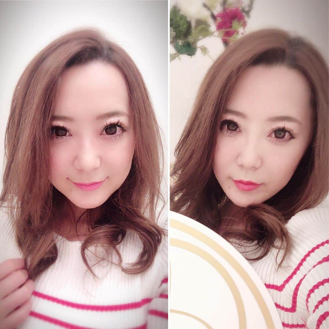 のインスタグラム：「この間 @a_clinic_ginza さんでリフトアップをしてきました🙋‍♀️ 気になってた口角の横を少しだけ上げてもらったらまた別人になりました！ 改めて輪郭って大事なのねって確信しましたwww あとよく笑うから鼻の付け根に一点ボトックスもしていただきました❤️ これで心置きなく笑えます😍 ありがとうございました！  #aスレッド #小顔aスレッド #aclinic銀座 #エークリニック #美容 #小顔 #美肌#リフトアップ #美容外科 #美容皮膚科#美容クリニック #山田哲雄 #佐藤玲史#柴田貴志 #谷口弘樹」