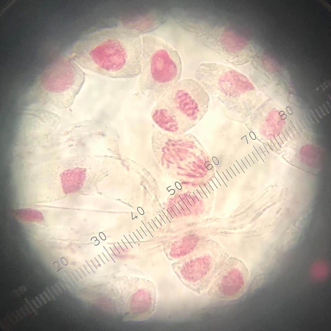 東京バイオテクノロジー専門学校さんのインスタグラム写真 - (東京バイオテクノロジー専門学校Instagram)「1年生の生物実習の様子👩‍🔬 ✴︎ ✴︎ 固定したタマネギの根を染色液で染めて、 光学顕微鏡で体細胞分裂を確認しました🌱  東京バイオでは1年生の時に 実験などを通して、 実験器具の使い方などを学びます🔎 #東京バイオ #東京バイオテクノロジー専門学校  #実験#理系#専門学校」6月4日 19時20分 - tokyobio