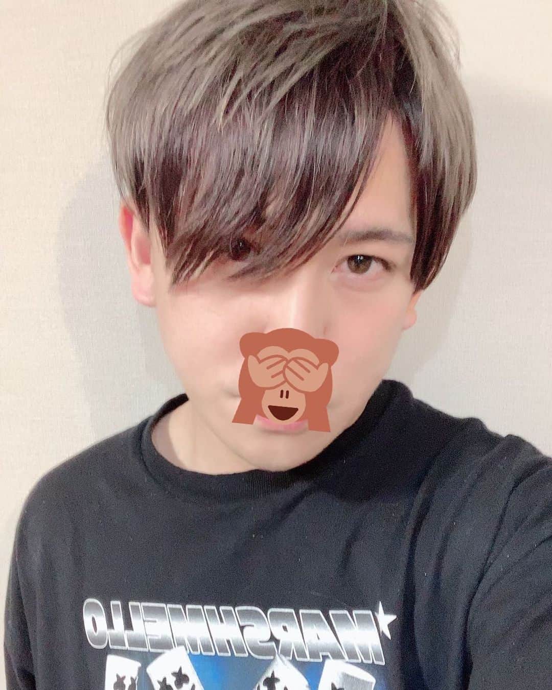 カブキンのインスタグラム：「イセアクリニックで 『ウルセラ小顔ハイフ』(切らないリフトアップ)を受けてきました。  2ヶ月後くらいに効果が一番出るって言われましたが、すでにここ数年で一番小顔感あります。  立先生ありがとうございました😌  @iseaclinic」