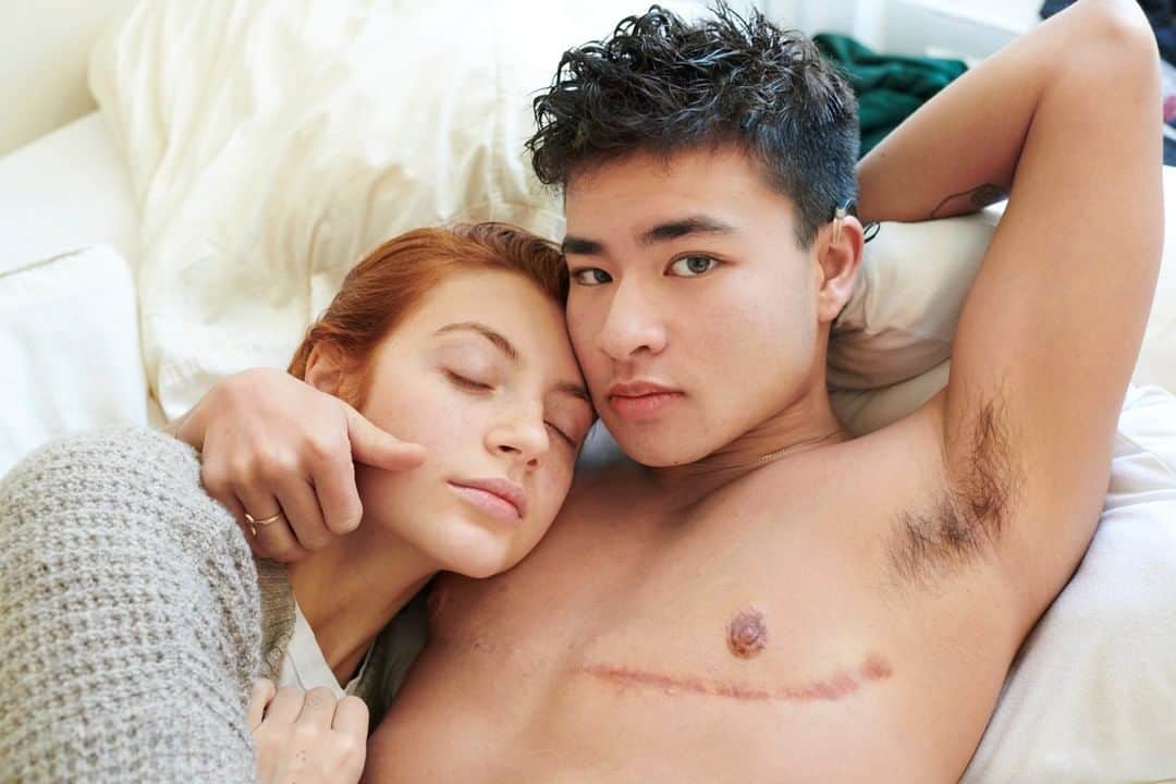 のインスタグラム：「Photo by Martin Schoeller @martinschoeller | Chella Man, model, artist, and activist, with girlfriend Mary V Benoit: "After publicly expressing my desire for top surgery, many people instantly expected me to get bottom surgery as well. It seemed impossible for others to separate the two in their mind, due to society’s views on normalcy. Any body outside of the binary anatomy of male and female is wrongly deemed abnormal. Because of this systematic view, I was encouraged to consider bottom surgery, even though it did not feel right. But there is no "right." Identities, bodies, and almost everything else in the world is on a spectrum. Luckily, I realized this and embraced my queer anatomy, while simultaneously rejecting society’s views on normalcy. In my opinion, normalcy should be discarded. It creates this mythical standard that forces individuals to compare themselves to others. The world should move toward the acceptance of bodies and identities as a spectrum without shame.  My body does not fit into the anatomical binary, and it is just as valid as those whose bodies do. The world’s lack of diversity should not influence one’s self-love. I should not feel forced to morph my body into others’ expectations and ideals. Neither should you." For more stories and portraits, follow me @martinschoeller and @martinschoellerstudio」