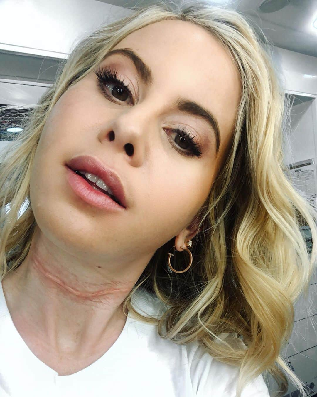 タラ・リピンスキーさんのインスタグラム写真 - (タラ・リピンスキーInstagram)「Tough week on the job. Getting slashed in the neck with a skate leaves it’s mark! In all seriousness, working with Jim Carrey and being a part of such an incredibly cool show is beyond any of my wildest dreams. #Kidding」6月22日 11時40分 - taralipinski