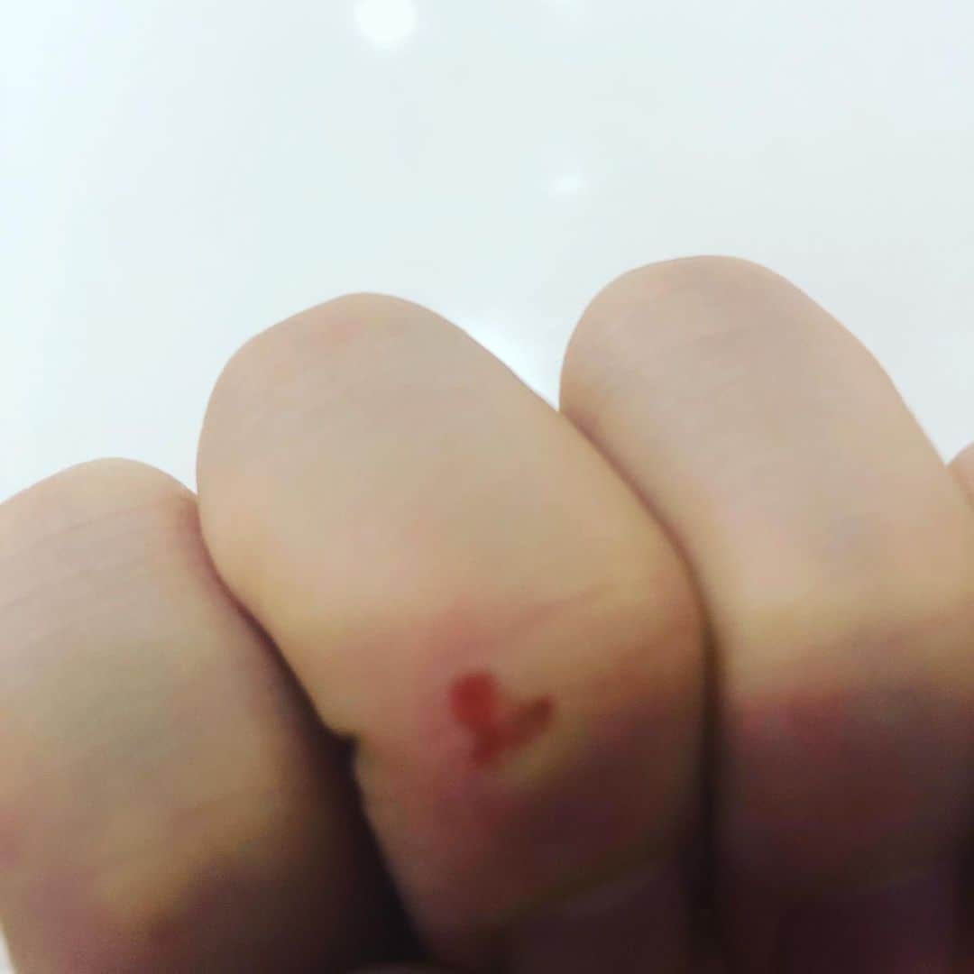 ウヒョン のインスタグラム：「❤️;;; 뭐지 신기;; 아프진않음ㅋㅋ 괜찮!」