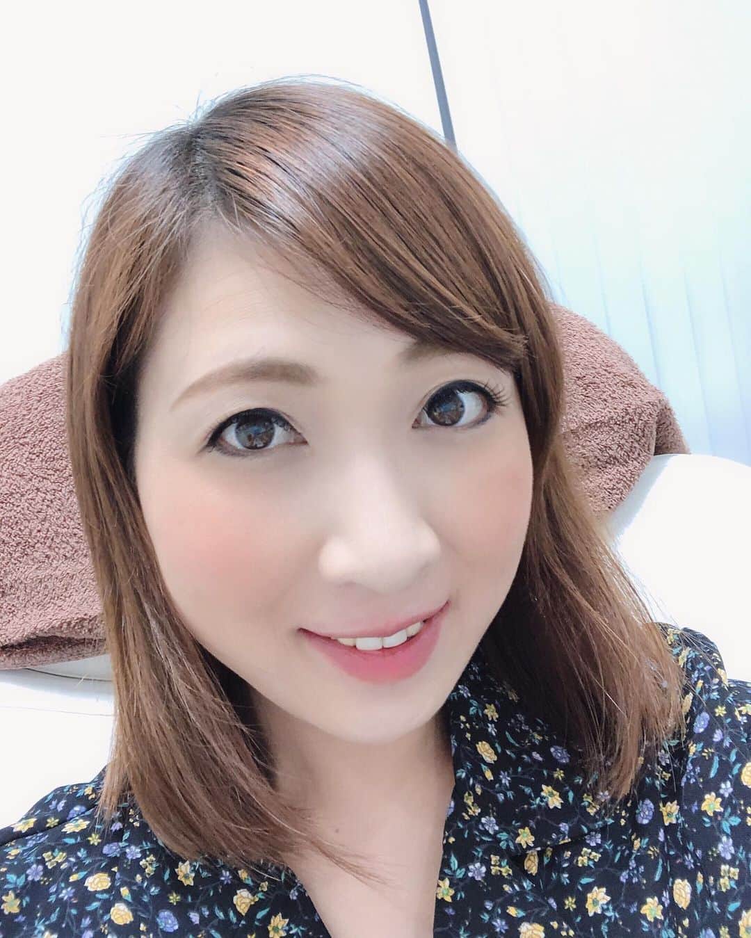のインスタグラム：「銀座TAクリニックさんへツヤ肌コラーゲンリフトの1ヶ月検診に行って来ました！  写真だと分かりづらいですが、顎のラインがキュッと上に上がって、フェイスラインがかなりスッキリしました！肌艶も良くなって、大満足の仕上がりです💕  紹介してくれたもえあずちゃん❣️ 施術をして下さった銀座TAクリニックの鎌田先生！  そして、銀座TAクリニックの皆様、ありがとうございました✨  #銀座taクリニック #ツヤ肌コラーゲンリフト #糸リフト #リフトアップ」