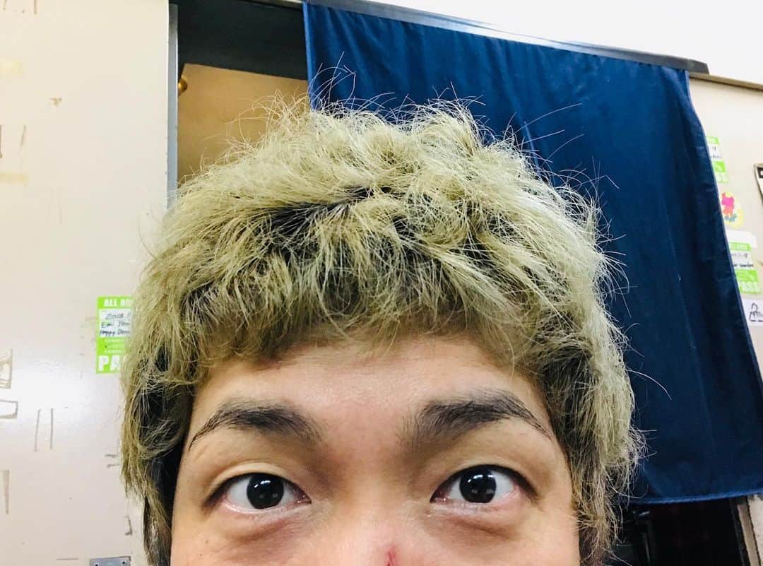 須賀真太郎さんのインスタグラム写真 - (須賀真太郎Instagram)「なんだか日に日にパーマがキツくなってる気がする。。。 湿気か。。。 髪が細くなったか。。。 いつかパンチパーマになるのか（笑）  あと鼻の傷がなおらない（笑）  #京都 #MUSE #ロットンの日 #ROTTENGRAFFTY #dustbox #20th」6月10日 20時19分 - sugacurry