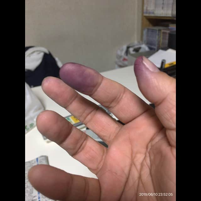 森田繁のインスタグラム：「うああああ、セブンイレブンで買った冷凍ブルーベリーを食べただけなのに！」