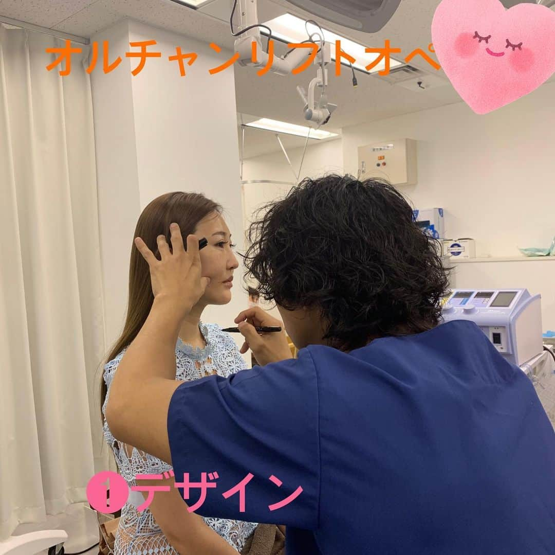 東京美容外科公式さんのインスタグラム写真 - (東京美容外科公式Instagram)「大人気の糸リフト オルチャンリフトの流れになります✨  デザインから完了まで1時間くらいで お手軽にしっかりリフトアップできます✨✨ 今回は左右で5本ずついれています^ - ^ ⚠️内出血、若干の腫れ、なじむまで凸凹感ででる場合がございます。 ==🎁お問い合わせはこちら🎁==== 詳しくはプロフィールのURLから公式サイトへ♪ ▼フリーダイヤル 0120-658-958 （コールセンター受付時間：9：00～21：00） ▼LINE予約 @ tkc110 ============== #東京美容外科 #東京美容外科新宿院 #審美 #美容整形 #きれい #整形 #美活 #綺麗になりたい #美肌 #美意識  #美容外科 #プチ整形 #インビザライン#アンチエイジング #美容好き #歯科ドッグ #美容整形外科 #二重 #埋没法 #タルミ #小顔 #目の下のくま #涙袋 #東美美人#オルチャンリフト」6月11日 15時26分 - tokyobiyougeka_jimukyoku