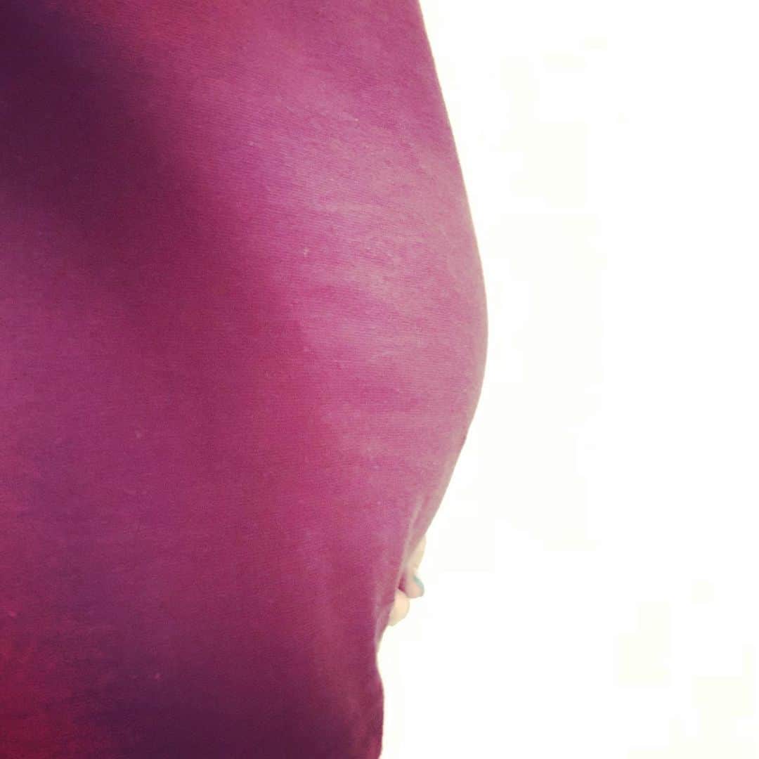 岡村咲さんのインスタグラム写真 - (岡村咲Instagram)「無事3ホールまわれましたー🏌️🏻‍♀️楽しかったー！！！ちょっと症状出て辛いので、改めて近日中にスイング乗せますね😭見てー。お腹ここまで成長してしまって腹痛が半端なくて涙😢消化管に血管性浮腫が集中的に出ている模様。つま先が見えなくなりました💣#血管性浮腫 #消化管血管性浮腫 #sle #全身性エリテマトーデス」6月13日 22時16分 - sakiokamura_official