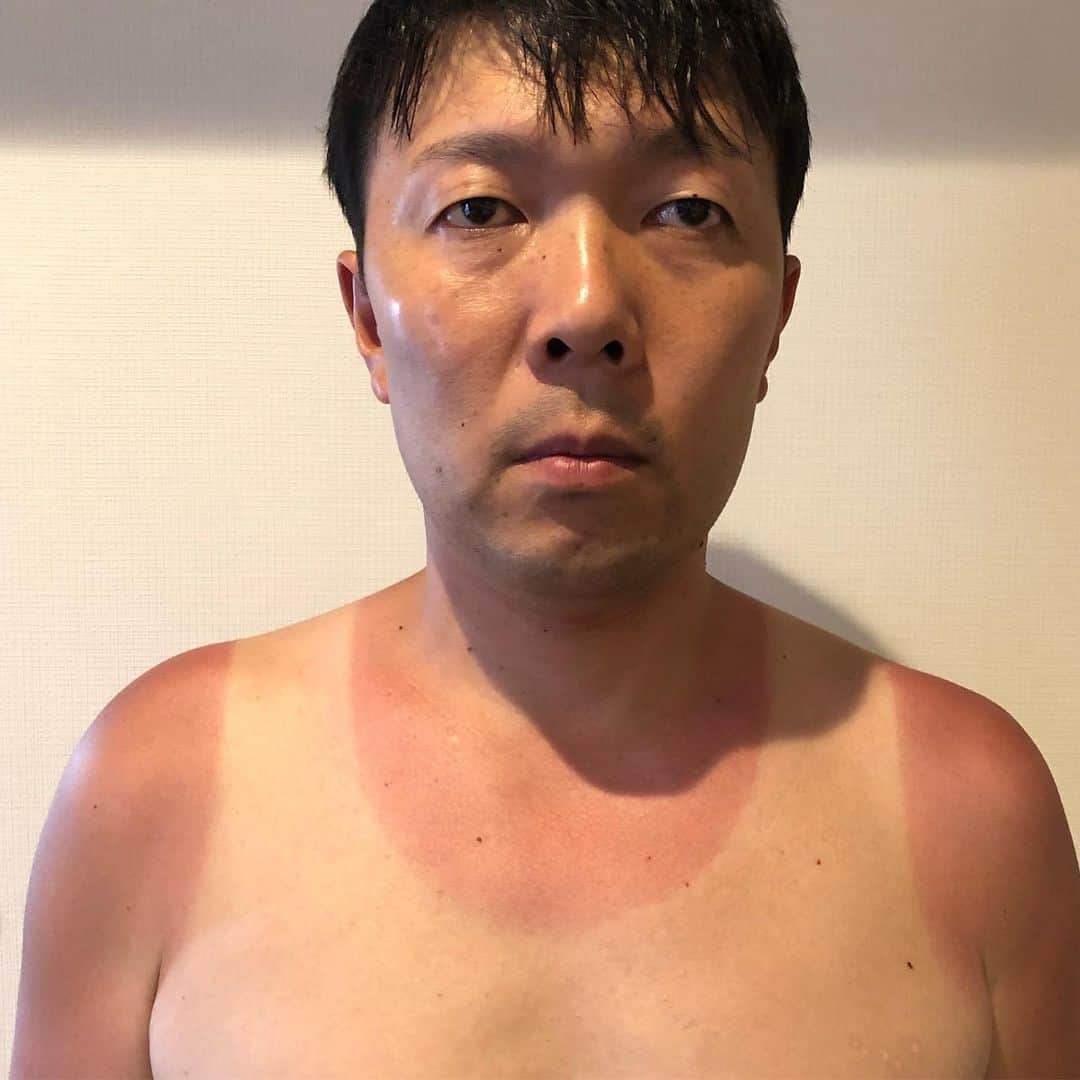 オラキオさんのインスタグラム写真 - (オラキオInstagram)「夏の始まり。  #オラキオ #日焼け #ランニング焼け #体操選手焼け #海行くと恥ずかしい」6月17日 19時48分 - matsuyukiorakio