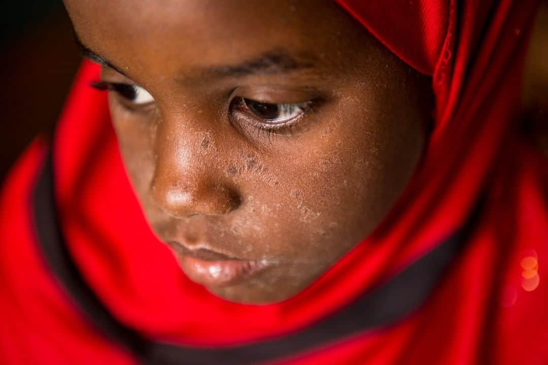 unicefさんのインスタグラム写真 - (unicefInstagram)「Last year, 1 in 10 of the world’s children missed out on life-saving vaccines. That meant 20 million children like Hourouki were left at risk of serious diseases. She caught measles in Mali, and she deserved so much better.  It's time to reach every last child. #VaccinesWork ©UNICEF/UN0293812/Keïta」7月15日 22時05分 - unicef