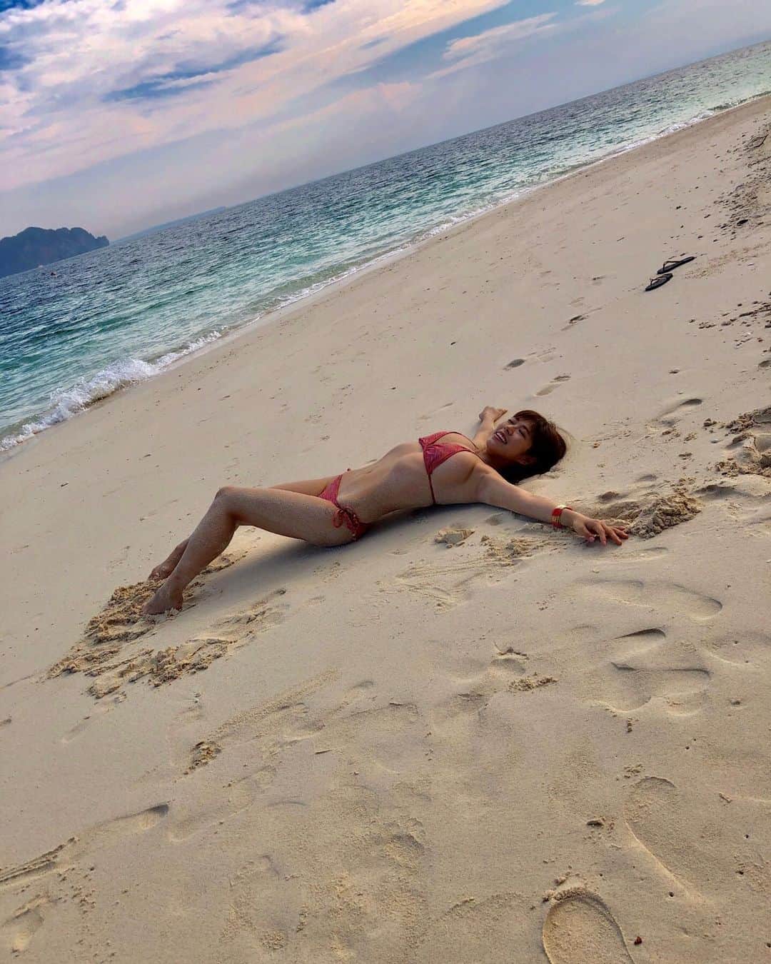 わちみなみのインスタグラム：「先日視力矯正手術を受けたのですが、﻿ すごく生活しやすくなりました☺︎﻿ ﻿﻿ わたしが受けたのはICLで﻿ レーシックとはまた違って﻿ 眼内にコンタクトレンズを入れるもので﻿、、﻿ ﻿﻿ もともと左目だけ視力が悪かった(0.2くらい)のですが﻿ 右目(1.5-2.0くらい)は良かったのでレンズをいれなくても﻿﻿ なんとなく見えてしまったのと、﻿ ドライアイやアレルギー体質﻿﻿ などがあってコンタクトを入れられない生活が続いていたんだけど、、💦﻿﻿ (ワンデーコンタクトを1日に何回もつけなおしたり、装着して2時間ぐらいで取っちゃったりしてたなあ💦もったいない笑)﻿ ﻿﻿ 眼精疲労、偏頭痛、、﻿﻿ 斜視が進む、ものがしっかりとらえられないことを考えて受けることにしました！﻿﻿ ﻿ あとドライアイの人も受けられるし、レンズの将来的な取り出しも可能らしいです⏏︎ ﻿ ﻿ 術後、﻿ とにかくスッキリ見えるのに感動しています！﻿ 目に力が入りづらかったのが今はぱちっと開きやすくなったのもうれしい✨﻿ ﻿ 手術自体も3分程で終わり痛みもなく安心でした。﻿﻿ ﻿ もう合わないコンタクトレンズのせいで視界が曇って日々結膜炎に悩まないで済むのがうれしいです😭﻿ ﻿﻿ 知り合いに紹介していただいた﻿サピアタワーアイクリニックの﻿﻿ 北澤先生、ありがとうございました☺︎☺︎✨✨﻿ ﻿﻿ 撮影でもコンタクトすぐ取っちゃってたから、﻿ この写真のビーチとか綺麗な風景を視力が良い状態で見たいな☺️⭐️﻿ ﻿﻿ #ICL #視力矯正 見えるのがうれしくてつい長文に笑✨ 手術中動画撮ってもらったんだけど、見せる相手がいない笑」