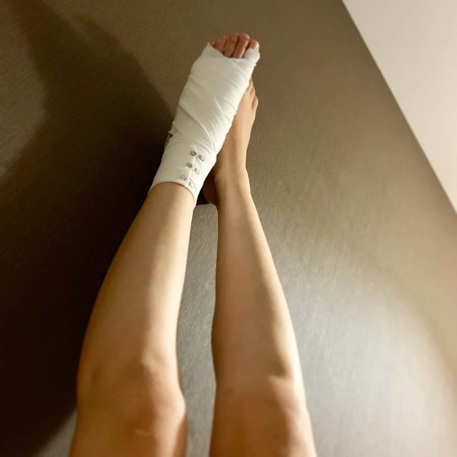 のインスタグラム：「骨折してたのー 人生初めての  気付かずにヒールでがしがし歩いてた👠  足だけでよかったと思いましょう！  土曜日フラの発表会。🙄 踊っていいよって言われた笑 いいのかな？笑笑  #骨折 #痛くない #けどなんかショック #ごろごろにゃん #こういうとき優しさが沁みしみ #明日健康診断 #不健康🙄」