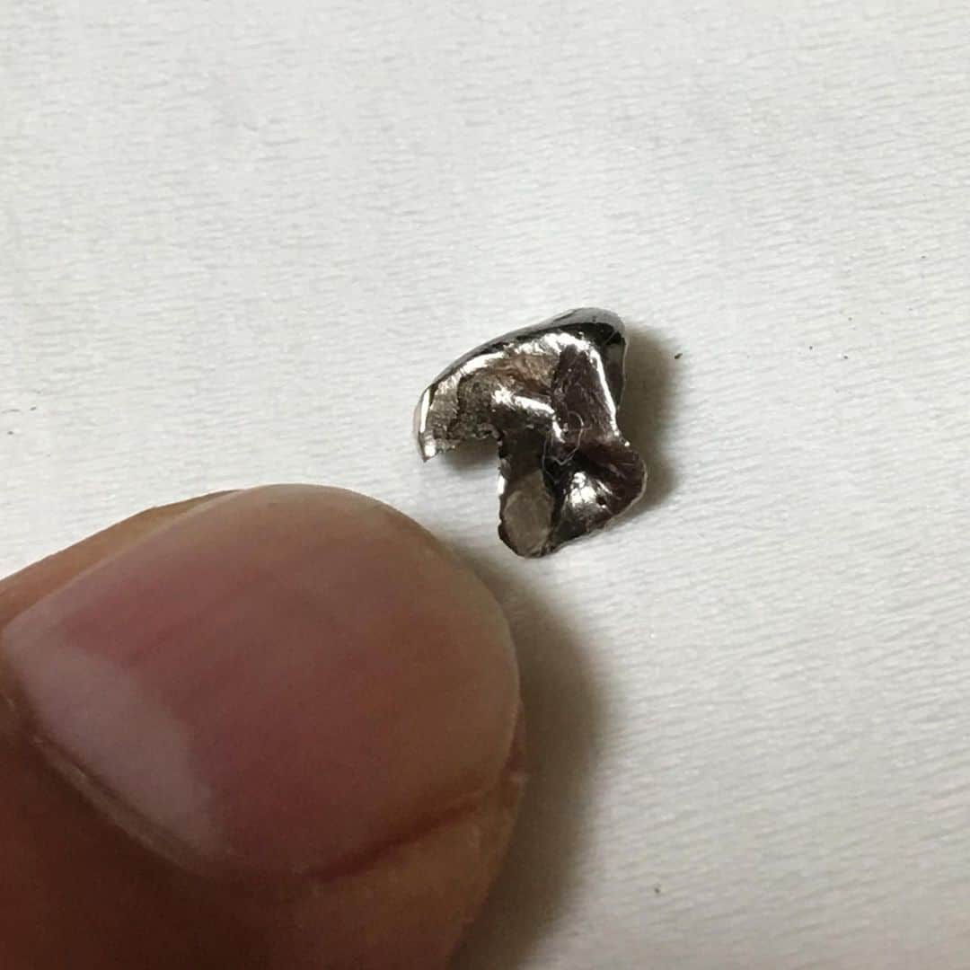 森田繁のインスタグラム：「歯を磨いていたら、銀歯が剥離。これまた接着箇所に寿命がきたのか？ 昼間、歯肉炎の患部切除をしたばかりなのに……(-_-;)」