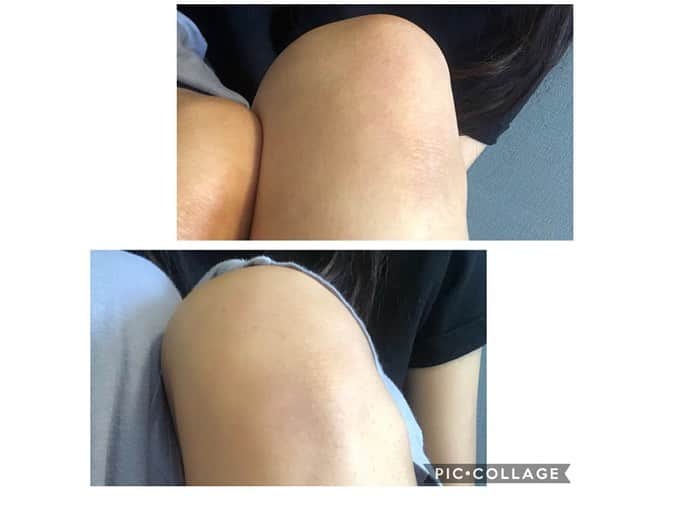 ANNA 杏奈さんのインスタグラム写真 - (ANNA 杏奈Instagram)「✈ 鏡を見る時に膝の色が段々気になったので、夏に向けて肌を出すからデリケートな部分に使う  LCラブコスメで人気の黒ずみ集中ケアソープ#ジャムウ・ハードバブル を最近使ってる👶💞 ・ @lclovecosmetic_japan ・ 海外でも有名で、独自の配分みたいだからこれにしました🧡 ・ 年齢からくる膝←🤣と肘によく使用してるので、before afterも載せておきます☝️ 泡を立てて、立てた泡をケアした部位に3分パックをしてから洗い流すのがおススメ❤️ 使って1週間くらい経った頃に違いが感じられたよ🙆‍♀ ・ ・ #ラブコスメ #デリケートゾーンケア #自然派石鹸 #黒ずみ #透明感 #自分磨き #女子力向上委員会」6月27日 20時31分 - anna_maria_end18