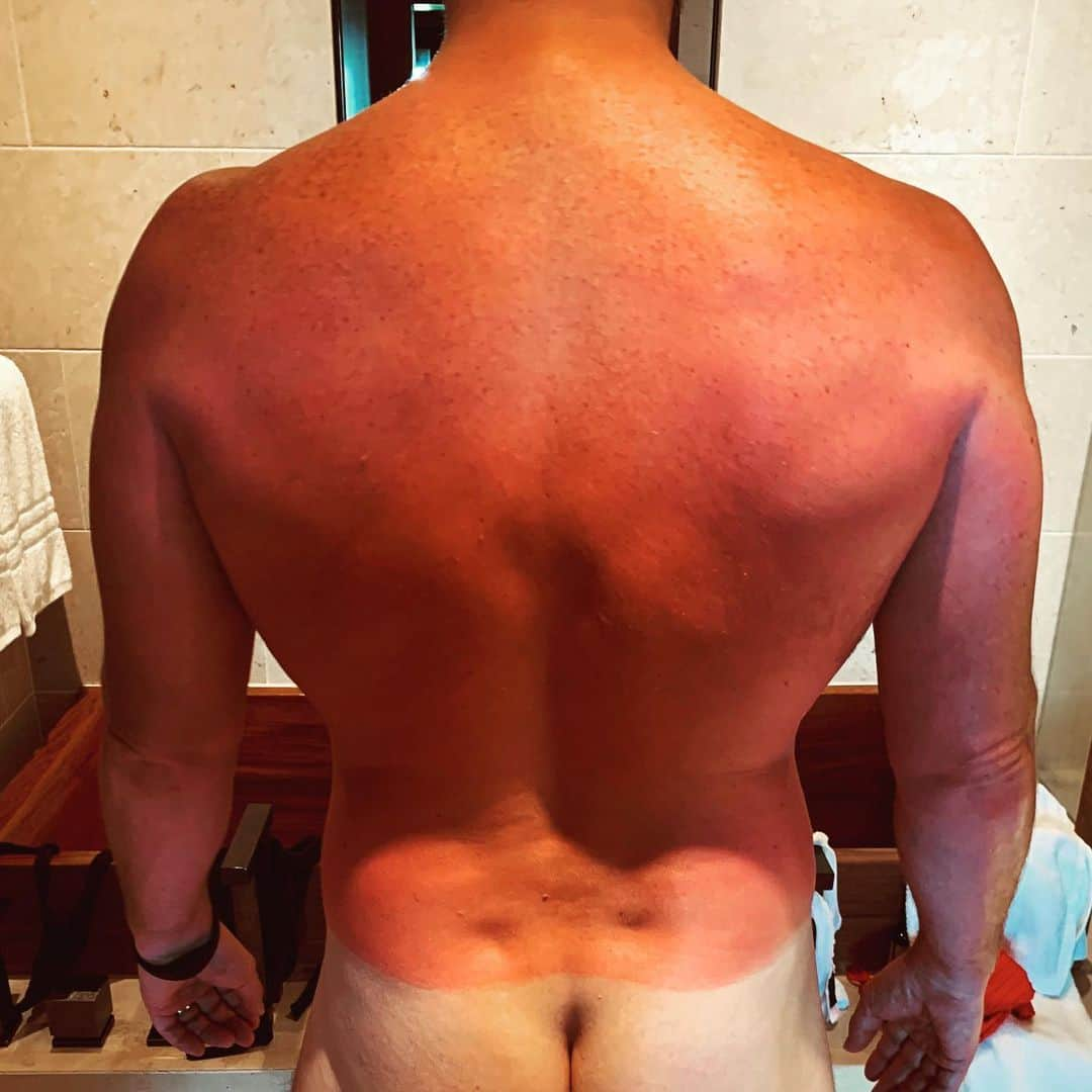 クリス・プラットさんのインスタグラム写真 - (クリス・プラットInstagram)「Suns out guns out I might have got a toouuuch crispy on the honeymoon #Aloe」6月30日 1時30分 - prattprattpratt