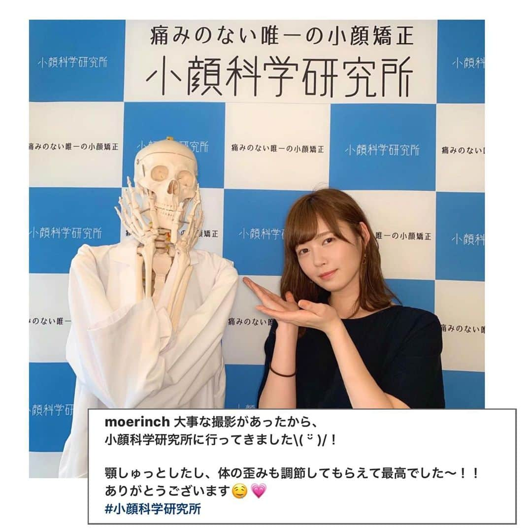 小顔科学研究所 さんのインスタグラム写真 - (小顔科学研究所 Instagram)「Youtuberのもえりん様が﻿﻿ 初回小顔矯正でご来店下さいました！💫﻿﻿ ﻿﻿ ﻿ 大切なお仕事前にご来店下さいました🙇🏼﻿ フェイスラインもすっきりして﻿ 顎がシュッとなった！と﻿﻿ とても喜んで下さいました🙏🏻✨﻿ ﻿﻿ ありがとうございました🎵﻿﻿﻿ またのご来店お待ちしております！﻿﻿﻿ ﻿﻿﻿ 小顔科学研究所では、小顔矯正の﻿﻿﻿﻿﻿﻿﻿﻿ 「お試しコース 39,800円(税別)」がございます！﻿﻿﻿﻿﻿﻿﻿﻿ 変化の程やお値段などでお悩み中の方はぜひ﻿﻿﻿﻿﻿﻿﻿﻿ 無料カウンセリングのみのご予約も可能です！﻿﻿﻿﻿﻿﻿﻿﻿ お気軽にお問い合わせ下さいませ♪﻿﻿﻿﻿﻿﻿﻿﻿ ﻿﻿﻿﻿﻿﻿ ﻿﻿﻿﻿﻿﻿ また美容鍼も初回5,000円(税別)で受けて頂けます！﻿﻿﻿﻿﻿﻿﻿﻿ 詳しくは2枚目の画像QRコードから﻿﻿﻿﻿﻿﻿﻿﻿ お気軽にお問い合わせ下さいませ♪﻿﻿﻿﻿﻿﻿﻿﻿﻿﻿﻿﻿﻿﻿﻿﻿﻿﻿ ﻿﻿﻿﻿﻿﻿﻿﻿﻿﻿﻿﻿﻿﻿﻿﻿ .﻿﻿﻿﻿﻿﻿﻿﻿ .﻿﻿﻿﻿﻿﻿﻿ ┈┈┈┈┈┈┈┈┈┈┈┈┈┈┈┈┈┈﻿﻿﻿﻿﻿﻿﻿﻿﻿﻿﻿﻿﻿﻿﻿ ﻿﻿﻿﻿﻿﻿﻿﻿﻿ ﻿﻿﻿﻿﻿﻿﻿ ﻿﻿﻿ #小顔 #小顔矯正 #骨盤矯正 #小顔科学研究所 #痛くない小顔矯正 #小顔サロン #小顔効果 #小顔はつくれる #芸能人御用達 #美容 #整体 #美容整体 #無痛矯正 #顔の歪み #むくみ #たるみ #東京 #表参道 #名古屋 #栄 #大阪 #心斎橋 #福岡 #天神 #smallerface  #美容鍼 #もえりん #YouTuber #youtuber」7月1日 12時20分 - kogaokagaku