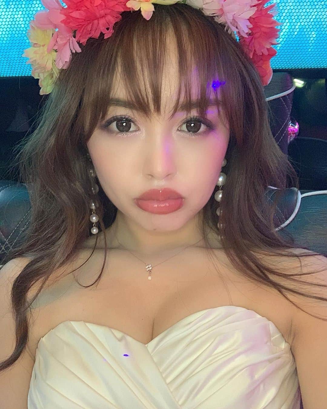板橋瑠美さんのインスタグラム写真 - (板橋瑠美Instagram)「初♡﻿ 目のクマ取り✨で印象アップ♡﻿ ﻿ ﻿ 私ね、顔が青白く、皮膚が薄いから﻿ 目の下のクマが目立ちやすいの🐻﻿ ﻿ ﻿ ﻿ 中学の頃、授業中に先生に﻿ ﻿ 「おい、大丈夫か？なんか顔色悪いぞ？保健室行くか？」﻿ ﻿ って何度言われたことかwww﻿ ﻿ ﻿ ﻿ ﻿ 目のクマって化粧品では隠せるけど﻿ やっぱりすっぴんになると﻿ げっそりして見えるし、﻿ 無いに越したことはない。﻿ ﻿ ﻿ 湘南美容クリニックでクマ取りの施術が﻿ あるらしく、﻿ 先日ストーリーで載せましたが、﻿ 人生初となる、オペにチャレンジしてきました☻﻿ ﻿ カウンセリングも丁寧にしてくれるし、﻿ 安心して受けられました^ ^﻿ ﻿ ﻿ ﻿ 内容としては、太ももの脂肪を自分のクマの上に注射で移動するの✨﻿ ﻿ ﻿ ﻿ 自分の脂肪だから、10〜20年も定着して居てくれるんだって♡﻿ ﻿ ﻿ 私でいうと、42〜52歳までだよ？！w﻿ めっちゃ良いよね✨﻿ ﻿ ﻿ ﻿ 最初ね、初オペで結構ドキドキしてたけど、﻿ 麻酔で爆睡してる間にあっという間に終わった♡！！！﻿ ﻿ ﻿ 武蔵小杉院の小池泰弘院長にご担当してもらい、﻿ 周りの看護婦さんたちとのチームプレイも凄くてさすが大手って違うなって安心して受けられました^_^﻿ ﻿ ﻿ ﻿ 湘南美容クリニック　武蔵小杉院の皆様ありがとうございました^_^﻿ ﻿ ﻿ ﻿ ﻿ ﻿ ﻿ ﻿ #SBC #湘南美容クリニック#湘南美容#美活#湘南美容クリニック武蔵小杉院#湘美女#すっぴんでもいい女#美容day#プチ整形#自分磨き#綺麗になりたい#美意識#湘南レポ#目の下の切らないたるみ取り#クマ#クマやばい#クマ取り#クマひどい#目の下のクマ#目の下のたるみ#目元ケア」7月1日 17時38分 - rumi_official_0616