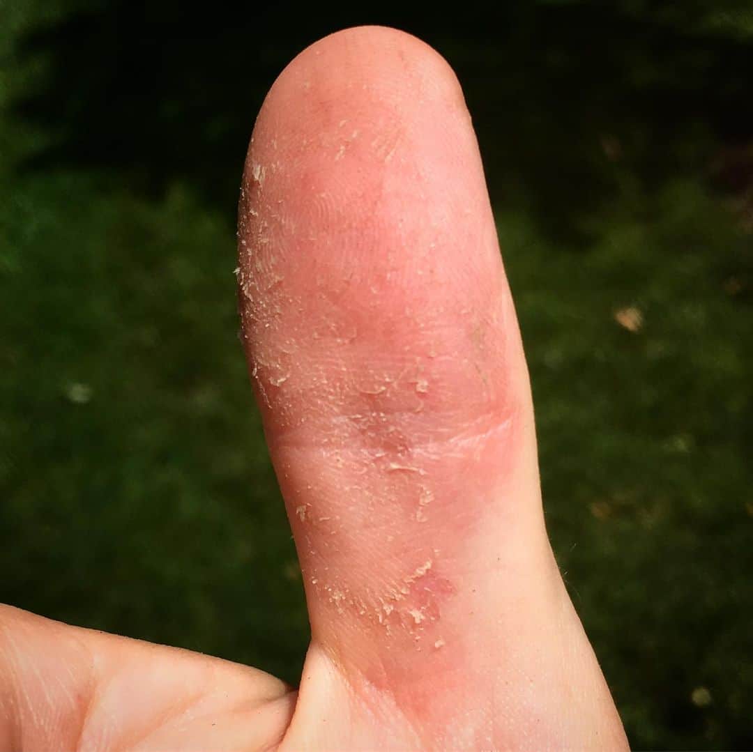 アウル・シティーのインスタグラム：「I never catch fish. It’s a curse. It’s like the fish inherently KNOW it’s me and the little brats stick up their noses and refuse to take my bait out of pure spite. “It’s HIM,” they mutter disdainfully as they give my lure a wide berth. 🎣 As a kid, it was always that way. The folks in the boats next to me would haul in one trophy bass after another while I helplessly looked on, seething with envy. If I had to guess, I’d say the people next to me caught 30 fish or more. I didn’t have to guess how many fish I caught... precisely zero. And so I’d cast out my line with disgust and spend the rest of the afternoon glaring coldly at the world from behind my sunglasses, silently cursing the lake and every blessed fish in it. 🎣 I realize now, I didn’t know what I was doing. I was probably throwing the wrong lure at the wrong time of day, per the wrong weather conditions. But come on. I was 10 years old. All I wanted was to catch one, ya know?? Just one! Even a small one, it didn’t even matter! Never happened. 🎣 Well, my friends, today that all changed. Today, by some supernatural alignment of the sun, the moon and the Milky Way, the fish came running. It was like every largemouth in the lake received a notification that I had arrived. They showed up in mobs, they crowded in from everywhere, they threw themselves at my spinnerbait, shouting “me next! me next!” It was like they felt sorry for me. I put my feet up, tilted my cap back on my head and reeled em in like a pro tournament bass fisherman. One after another. I couldn’t believe it. “But I’m the guy who can’t catch a fish to save his life,” I kept saying to myself. But there they were. Actual fish. And who was catching them?? Me. 🎣 The true sign of a good day of fishing is what they call “bass thumb.” Largemouth have very tiny teeth and when you lip one fish after another, your thumb starts to feel like sandpaper. This is a good thing. You WANT bass thumb. Bass thumb means you’re catching fish. If a guy tells you he caught dozens of bass, check his thumb. 🎣 Well, my friends, today was a first for me. Today, I finally caught a whole bunch of fish. 🎣 I finally got bass thumb. 🎣 Today was a beautiful day.」