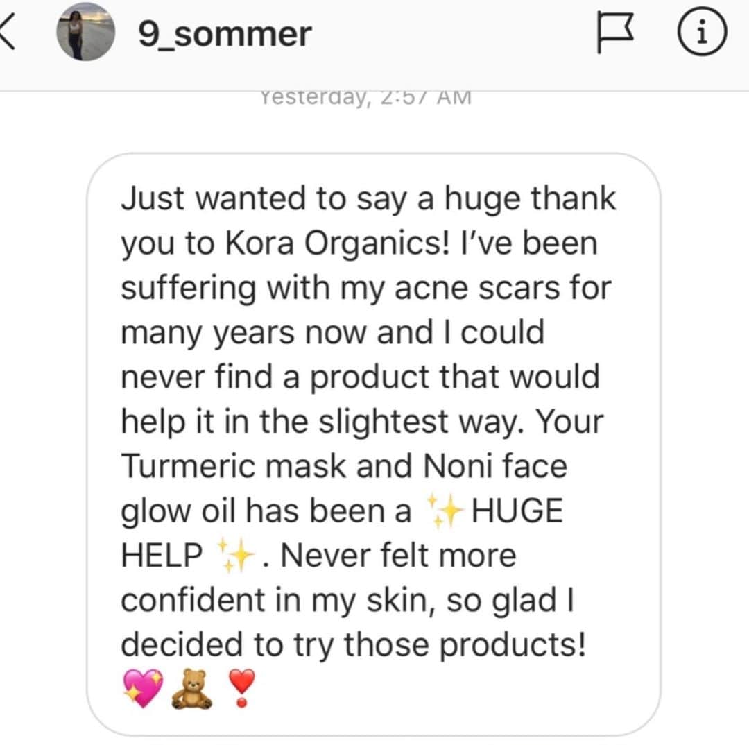 KORA Organicsさんのインスタグラム写真 - (KORA OrganicsInstagram)「Thank you Brittany @9_sommer for sharing your #MyKora experience with us! (Swipe left for Brittany’s testimonial!) 🦋 We’re so happy our products have helped reduce the appearance of your acne scars, helping you to feel “more confident” in your own skin! ✨ Have you experienced a #skintransformation since using KORA Organics? Tag @koraorganics and #MyKora in your before and afters. We 💖 sharing real results from real people! #KORAOrganics #MindBodySkin #NoniGlow」7月17日 9時25分 - koraorganics