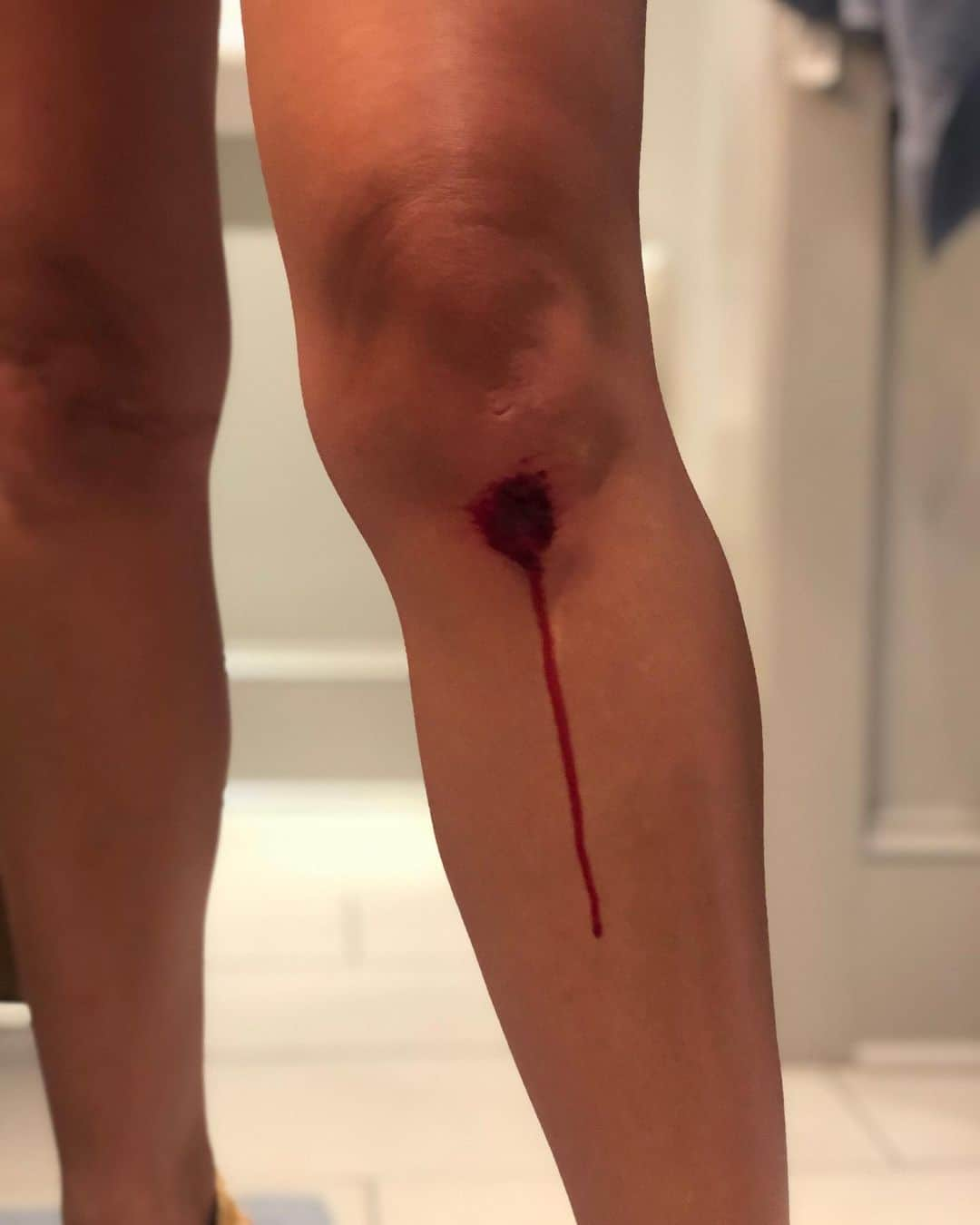 ビジー・フィリップスさんのインスタグラム写真 - (ビジー・フィリップスInstagram)「Same fucking knee. New trauma. 🤦‍♀️😂😭#thiswillonlyhurtalittle」7月7日 9時25分 - busyphilipps