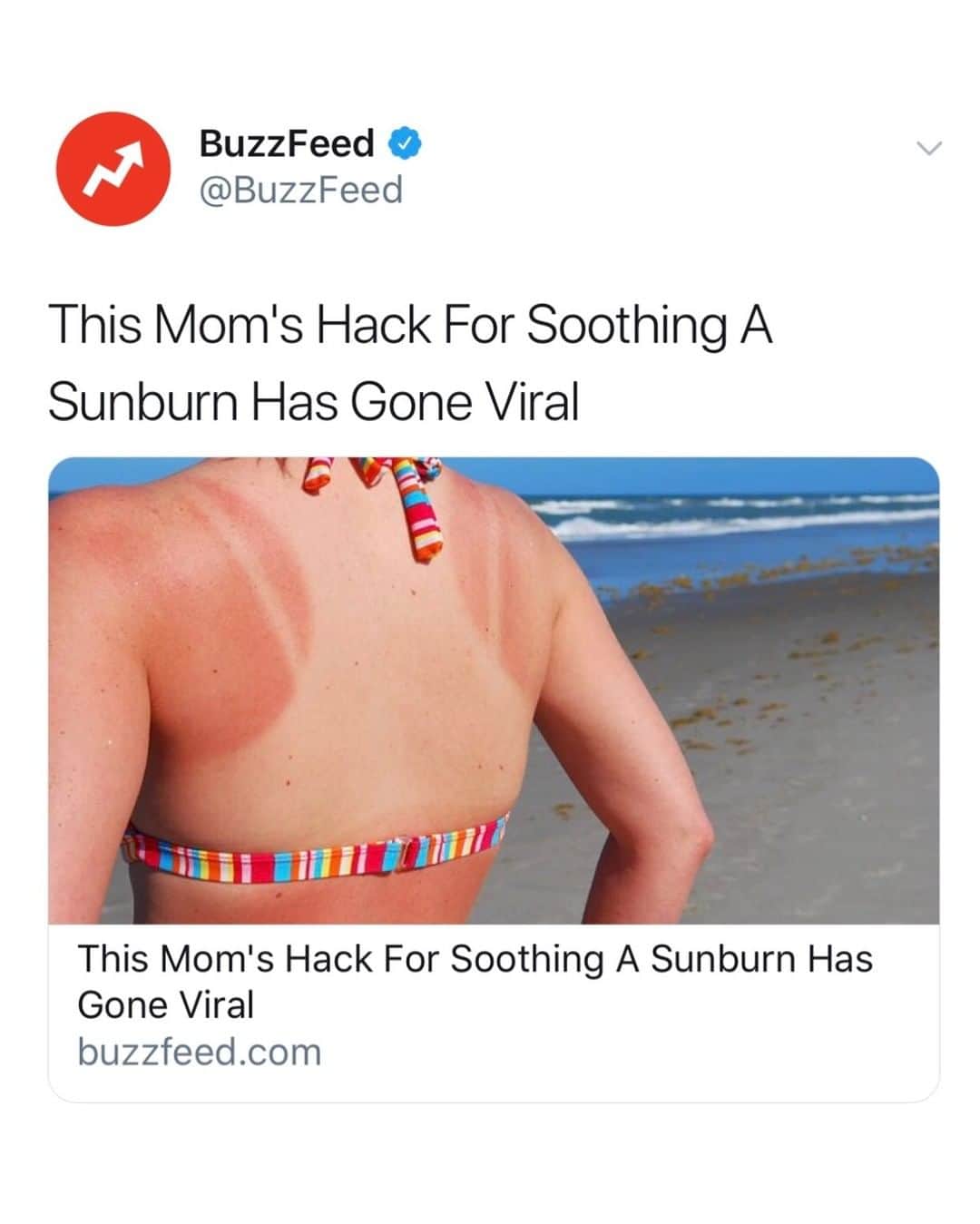 BuzzFeedさんのインスタグラム写真 - (BuzzFeedInstagram)「If you got sunburnt this weekend - this might help you out ☀️ Link in bio 🕶」7月8日 1時01分 - buzzfeed