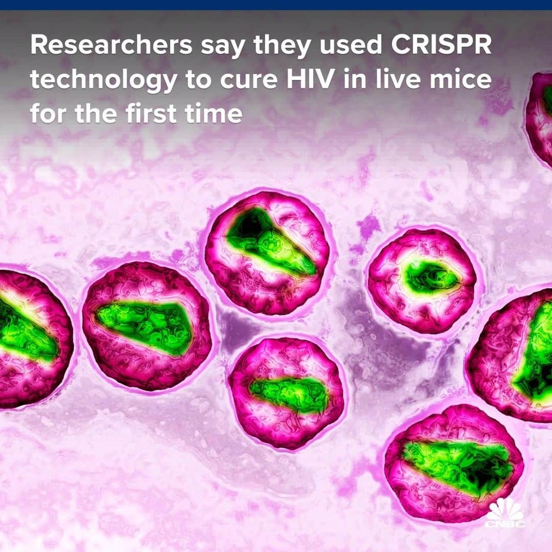 CNBCさんのインスタグラム写真 - (CNBCInstagram)「Researchers say they’re one step closer to finding a potential cure for HIV after successfully eliminating the virus in living mice for the first time.⁠ ⁠ “We think this study is a major breakthrough because it for the first time demonstrates after 40 years of the AIDS epidemic that the HIV disease is a curable disease,” said study co-author Dr. Kamel Khalili. ⁠ ⁠ Read more at the link in bio.」7月8日 11時00分 - cnbc