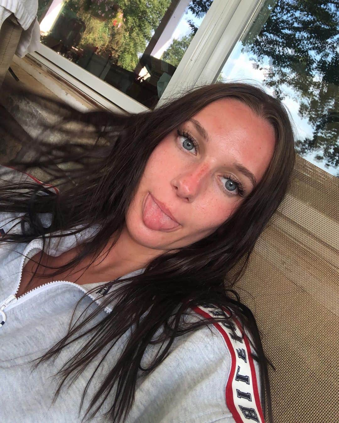 Nicole Kopchakのインスタグラム：「Girls with sunburn 😩😩😩👌🏼👌🏼💯💦」