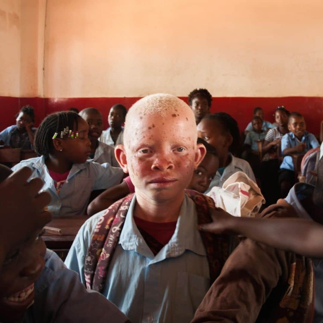 unicefさんのインスタグラム写真 - (unicefInstagram)「Many children living with albinism are isolated, abused and discriminated against. Lucas and his brother Jordão both have albinism. One day their father Jacinto heard a neighbour forbidding his children to play with them. He patiently explained to her that every child has rights, and asked her to make sure his boys were included in the future. Every child deserves to grow up and learn in a safe environment. Our differences - including nationality, culture, gender, disability, identity, sexual orientation, ethnicity, migration status, religion - make us unique and should be celebrated, rather than divide us. #ENDviolence © UNICEF/UN0324917」7月10日 3時45分 - unicef