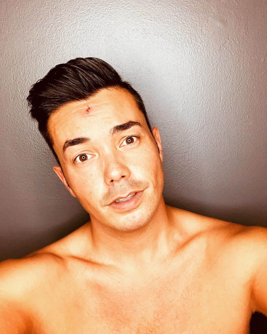 アンソニー・ラモスのインスタグラム：「Is a giant spider bite on your face a hot new trend for Summer? 🕷」